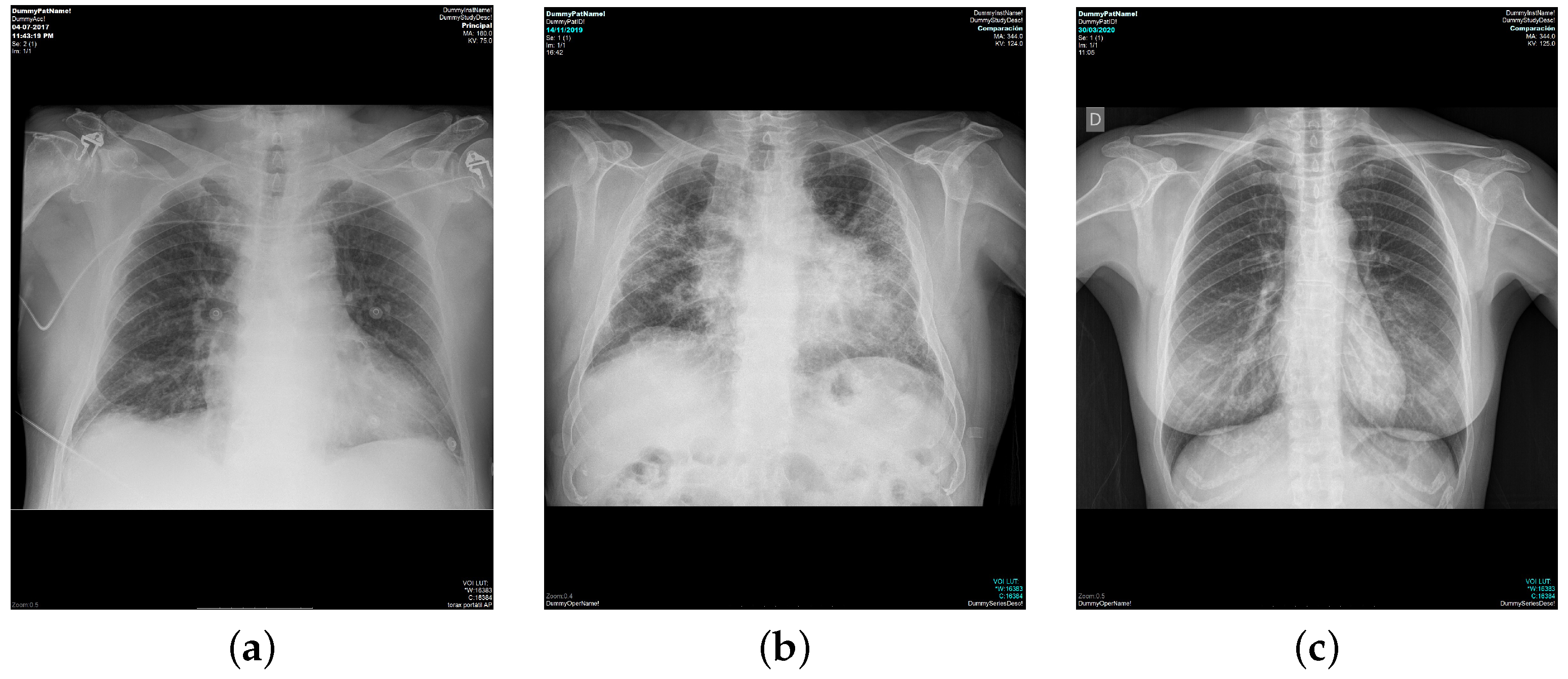 Engineering Proceedings | Free Full-Text | Computational Radiological ...