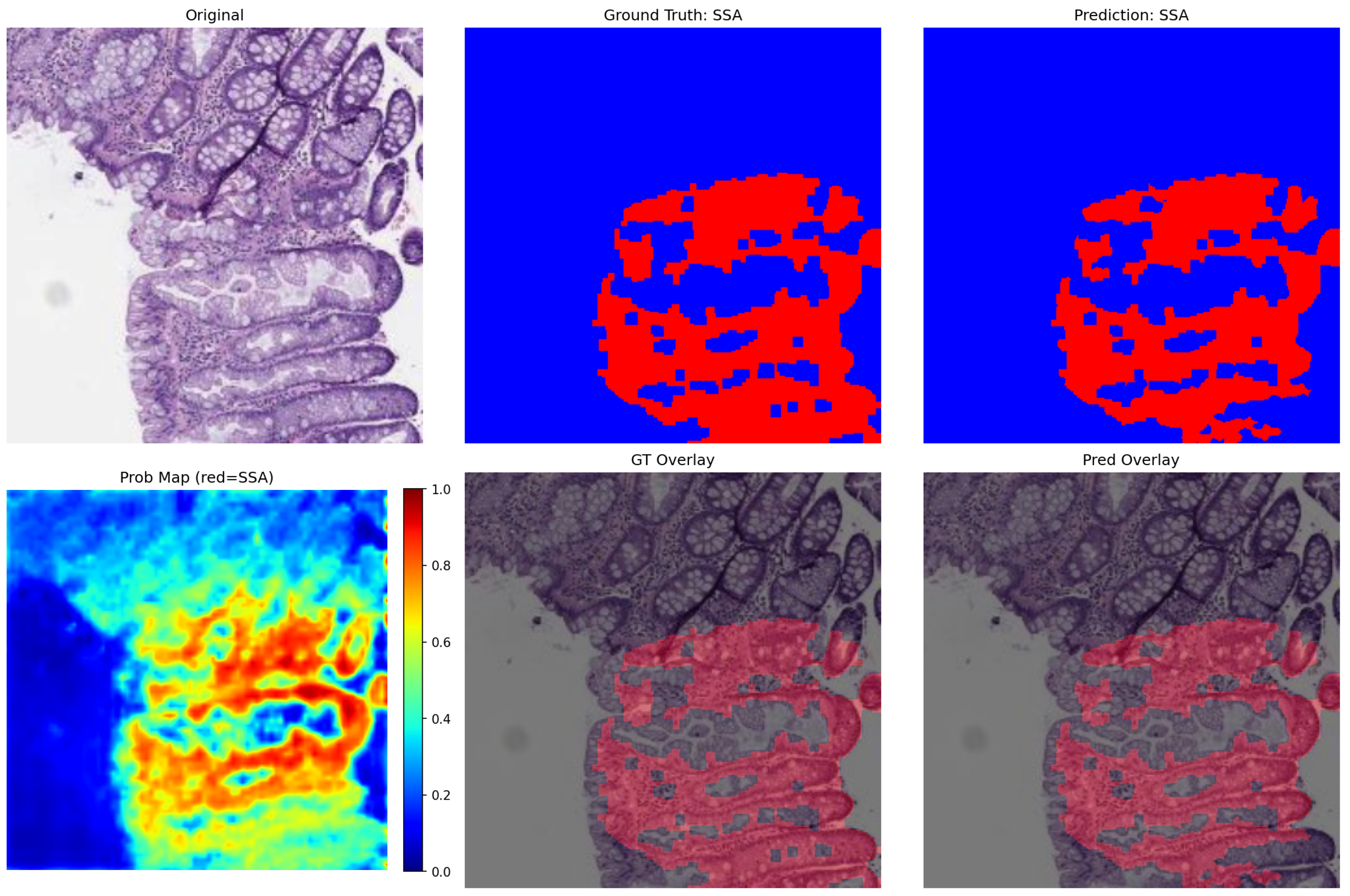 Evaluating Semantic Segmentation Performance Using DeepLabv3+ with ...
