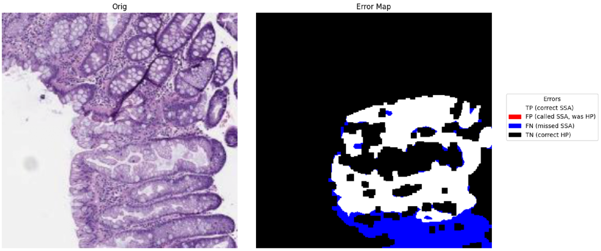 Evaluating Semantic Segmentation Performance Using DeepLabv3+ with ...