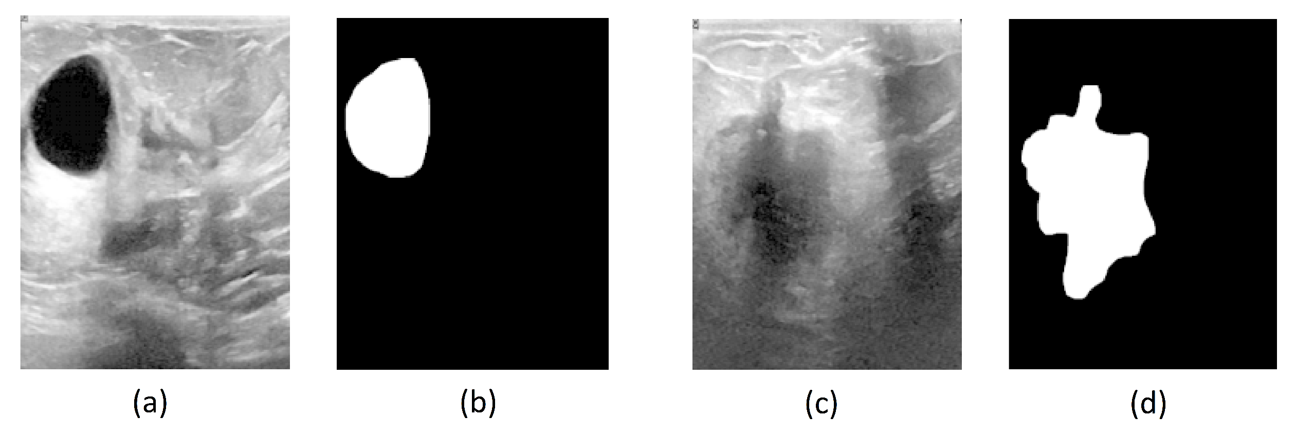 Real-time Burn Classification using Ultrasound Imaging