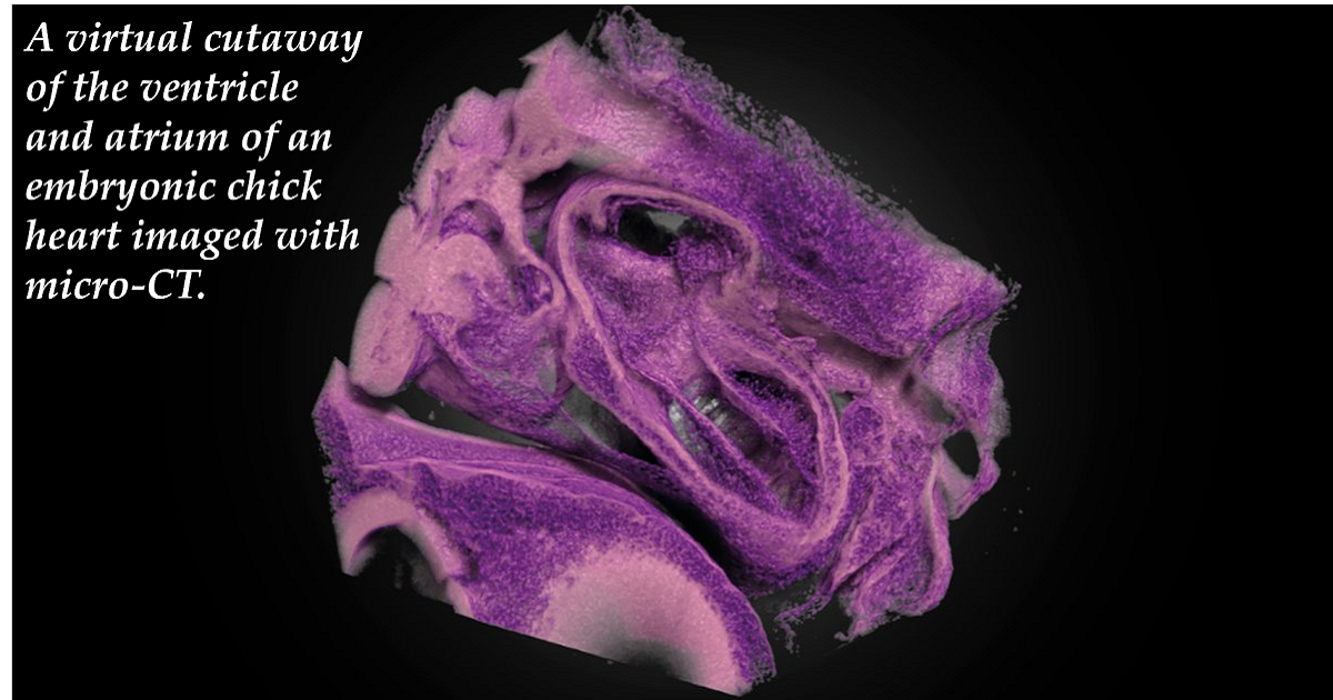 Graphical abstract - Nina Kraus