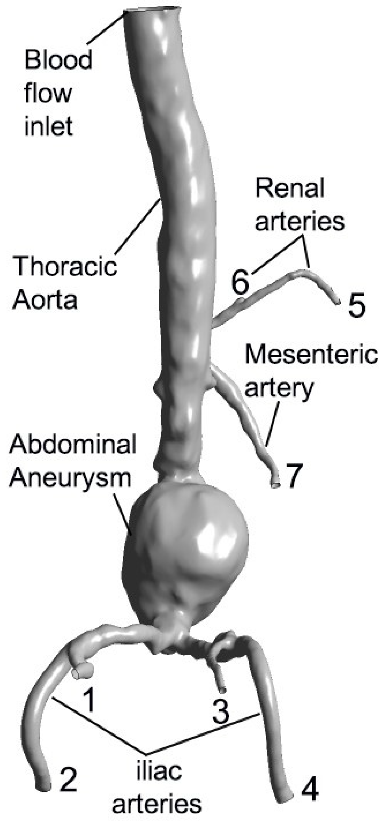 Placement of an Abdominal Wrap to Control Hemodynamics