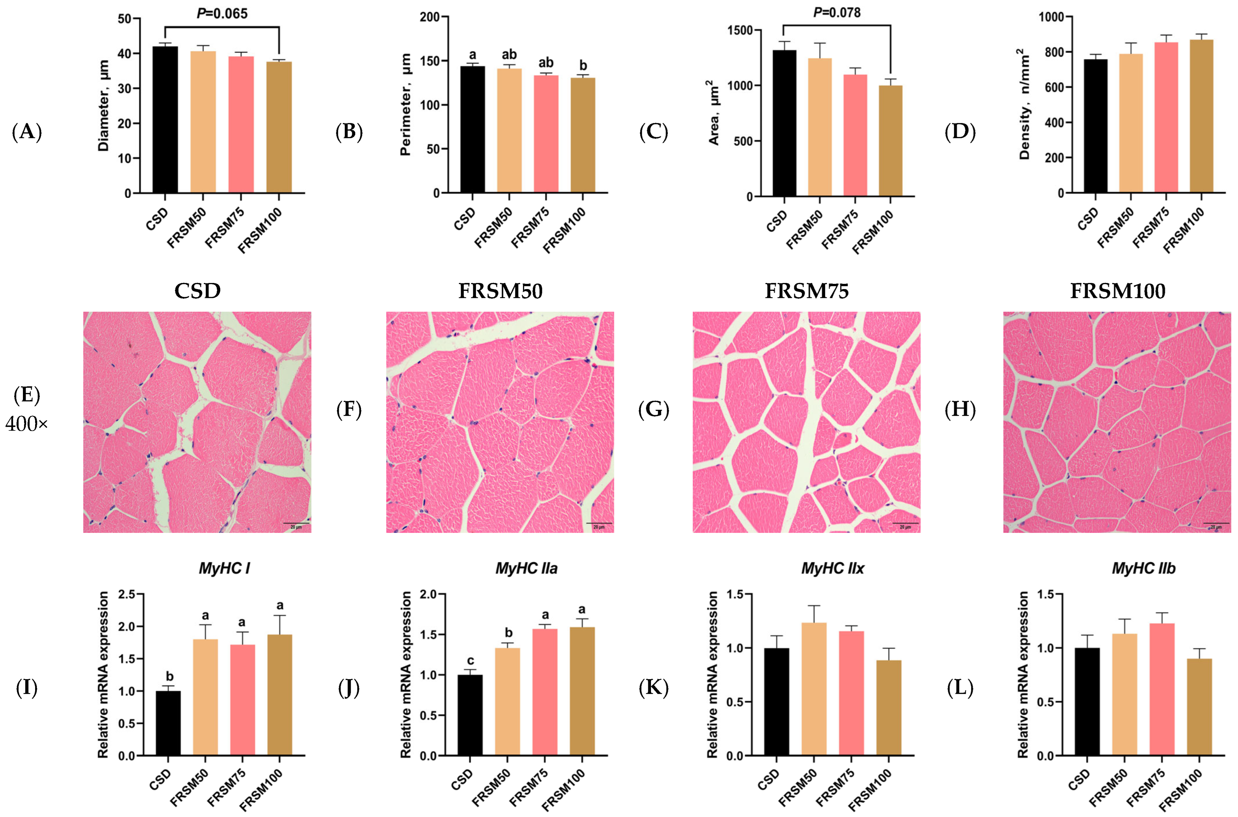 Improving Meat Quality and Lipid Metabolism of Finishing Pigs by ...