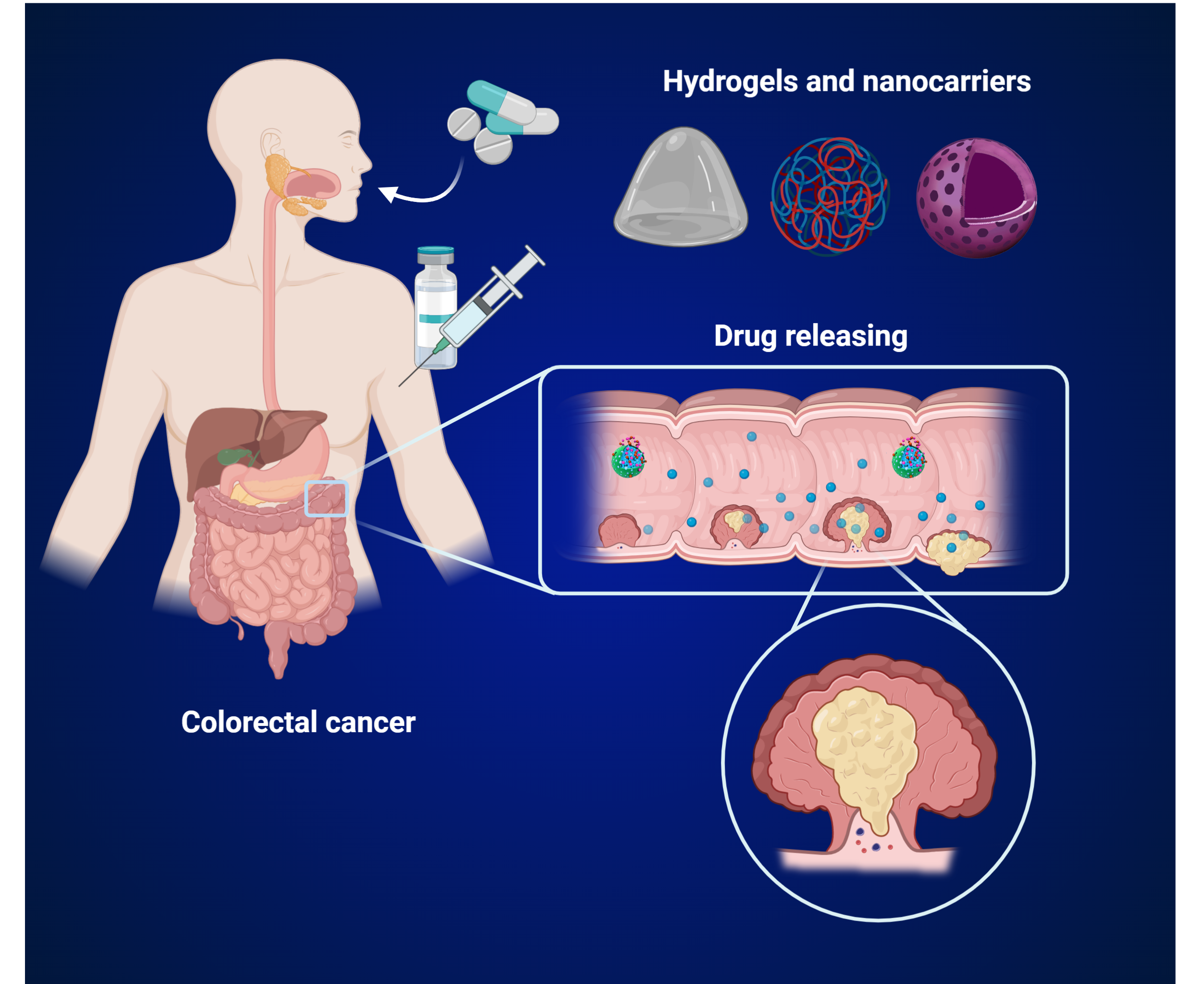 Gels Free Full Text Advances In Bio Based Polymers For Colorectal