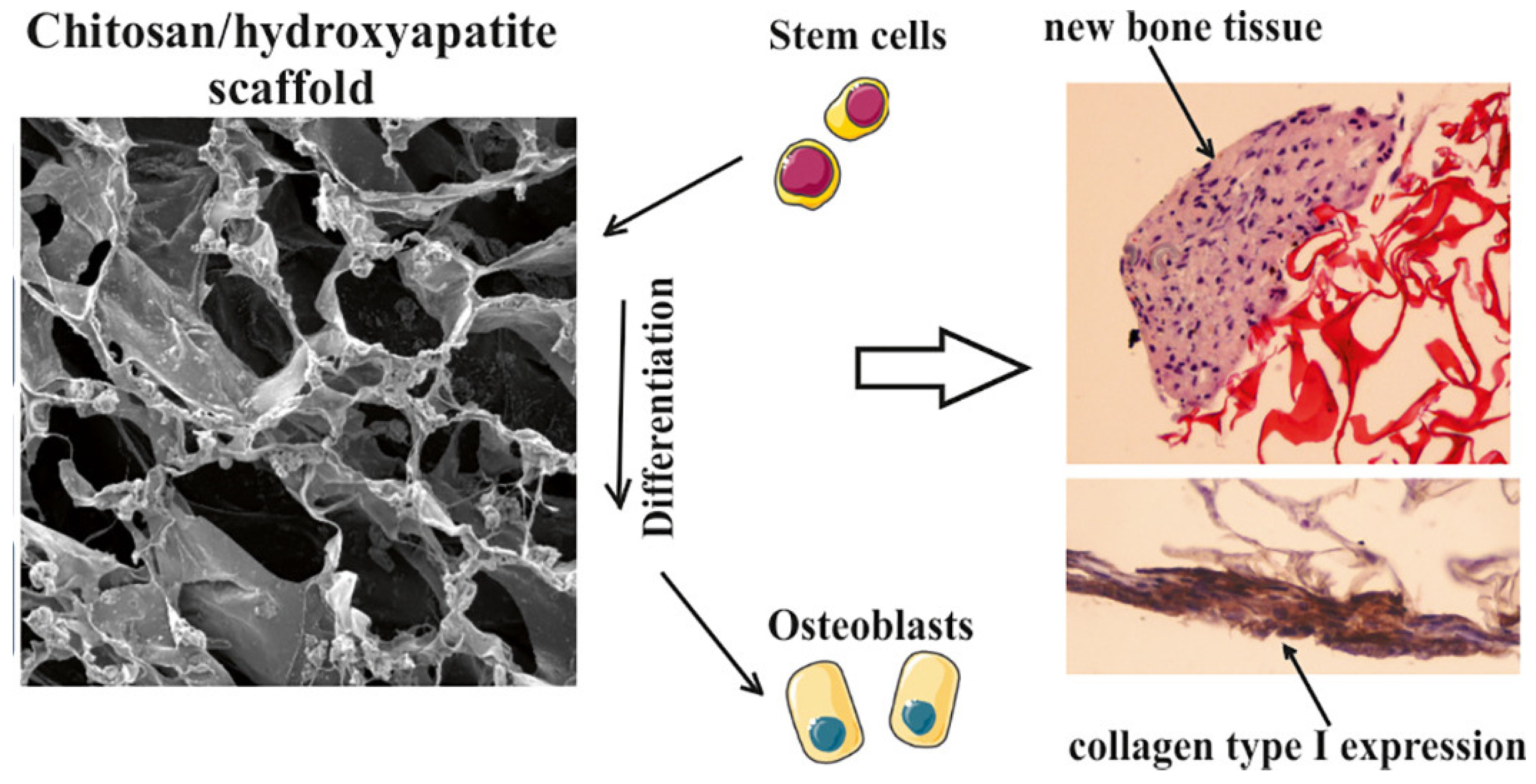 Recent Advances and Applications of Chitin and Chitosan Hydrogel ...