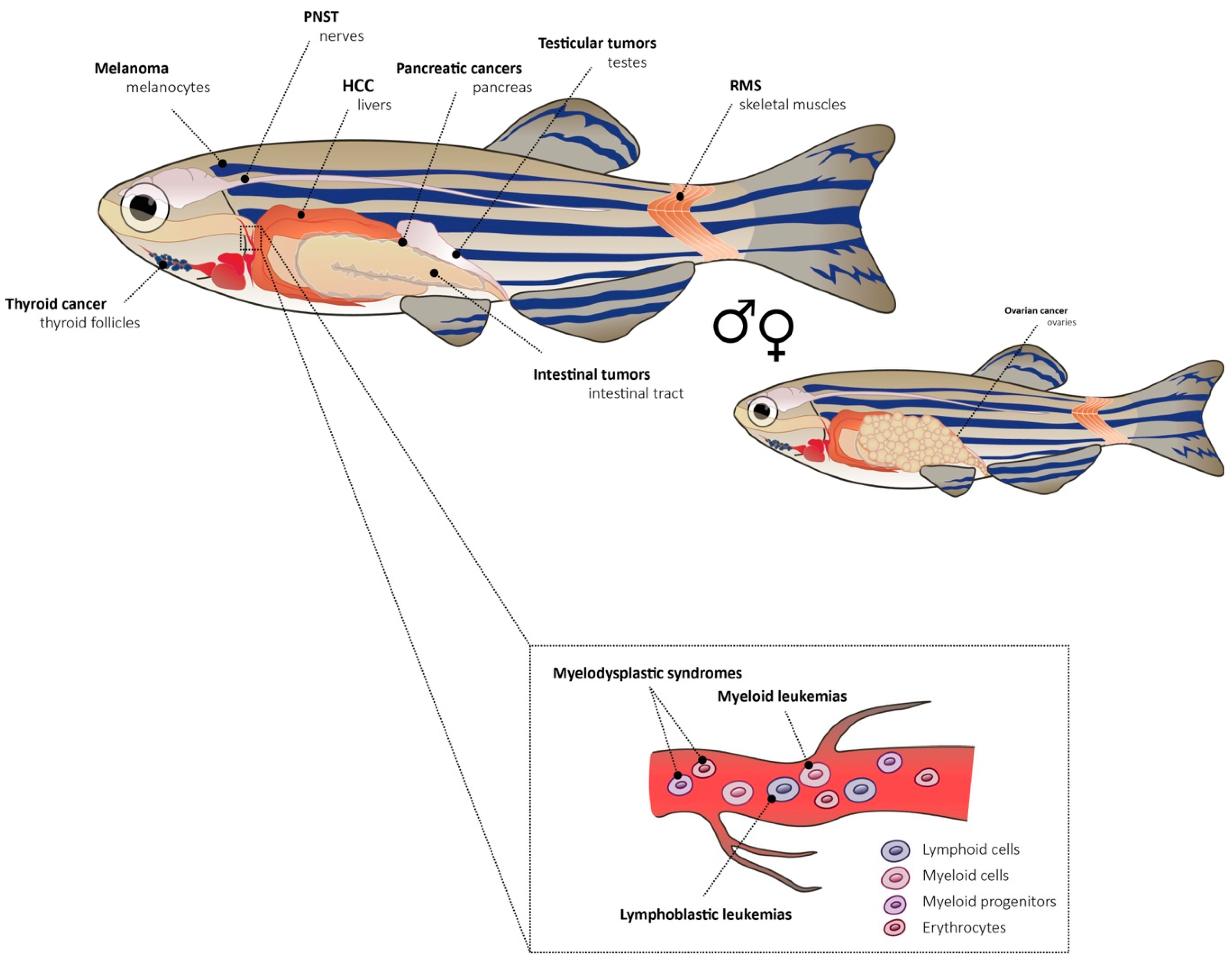Genes | Free Full-Text | Zebrafish Models of Cancer—New Insights on  Modeling Human Cancer in a Non-Mammalian Vertebrate