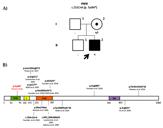 健康・医学 chat gene Pro CHST15 gene germline mutation is associated with the