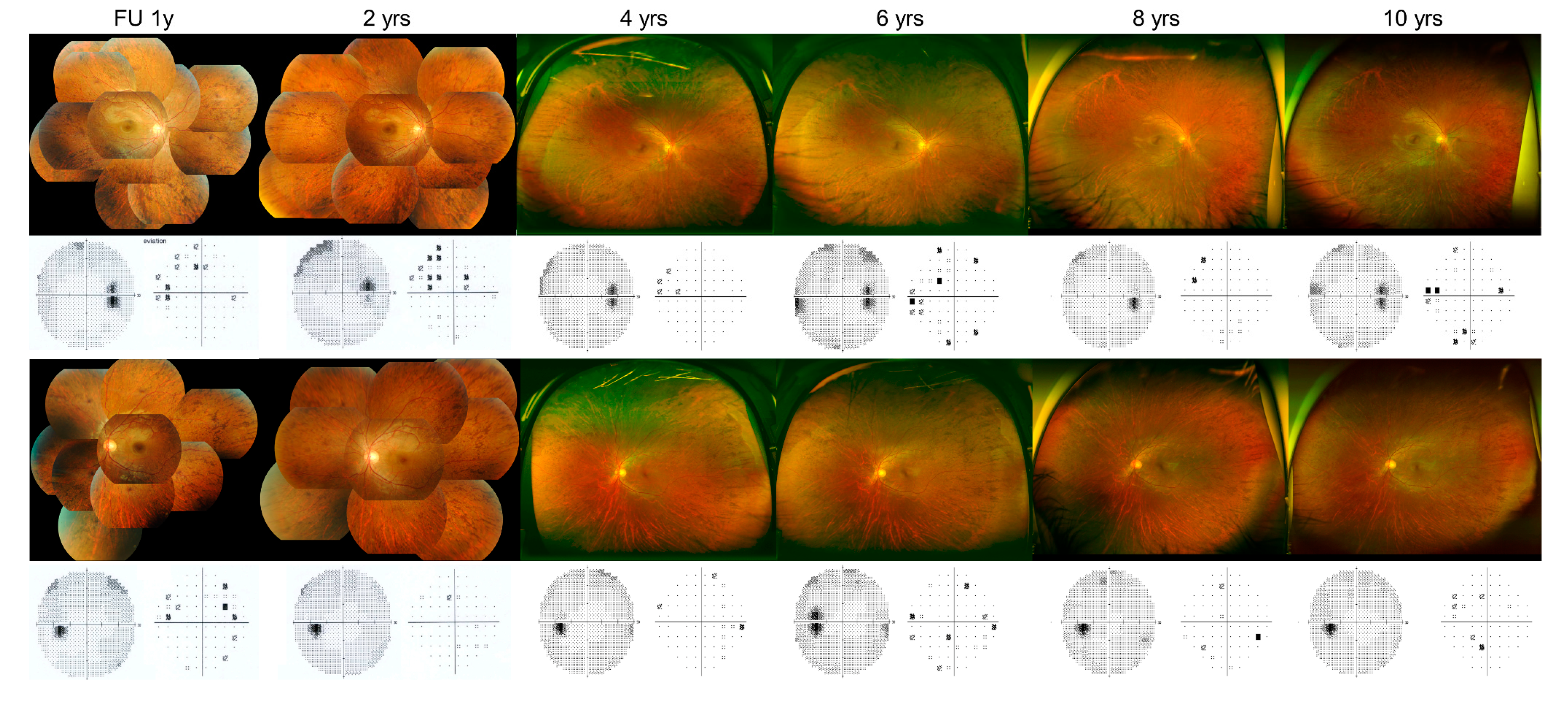 DAILY RETINA SPARGIFIAMMA 0082