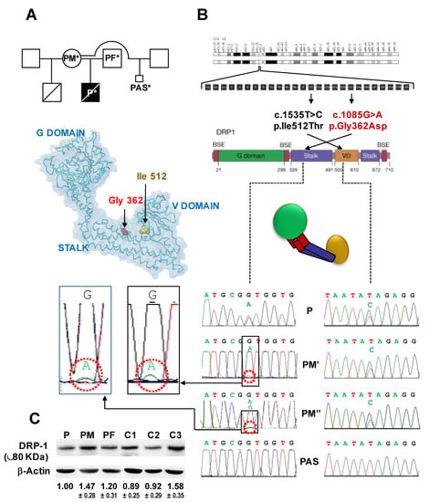 Genes Free Full Text Pathogenic DNM1L Variant 1085G A Linked To   Genes 12 01295 G001 550 