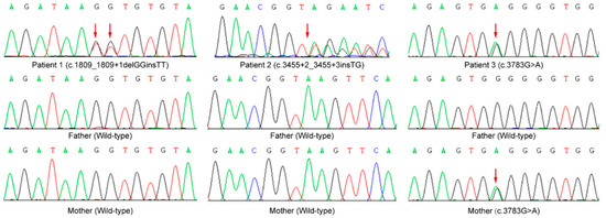 Genes | Free Full-Text | Novel Loss-of-Function Variants in CHD2 