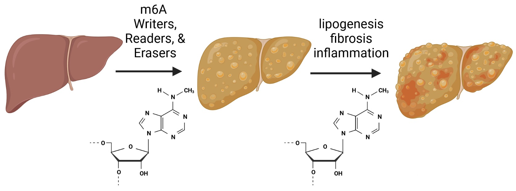 Genes | Free Full-Text | Changes in m6A in Steatotic Liver Disease