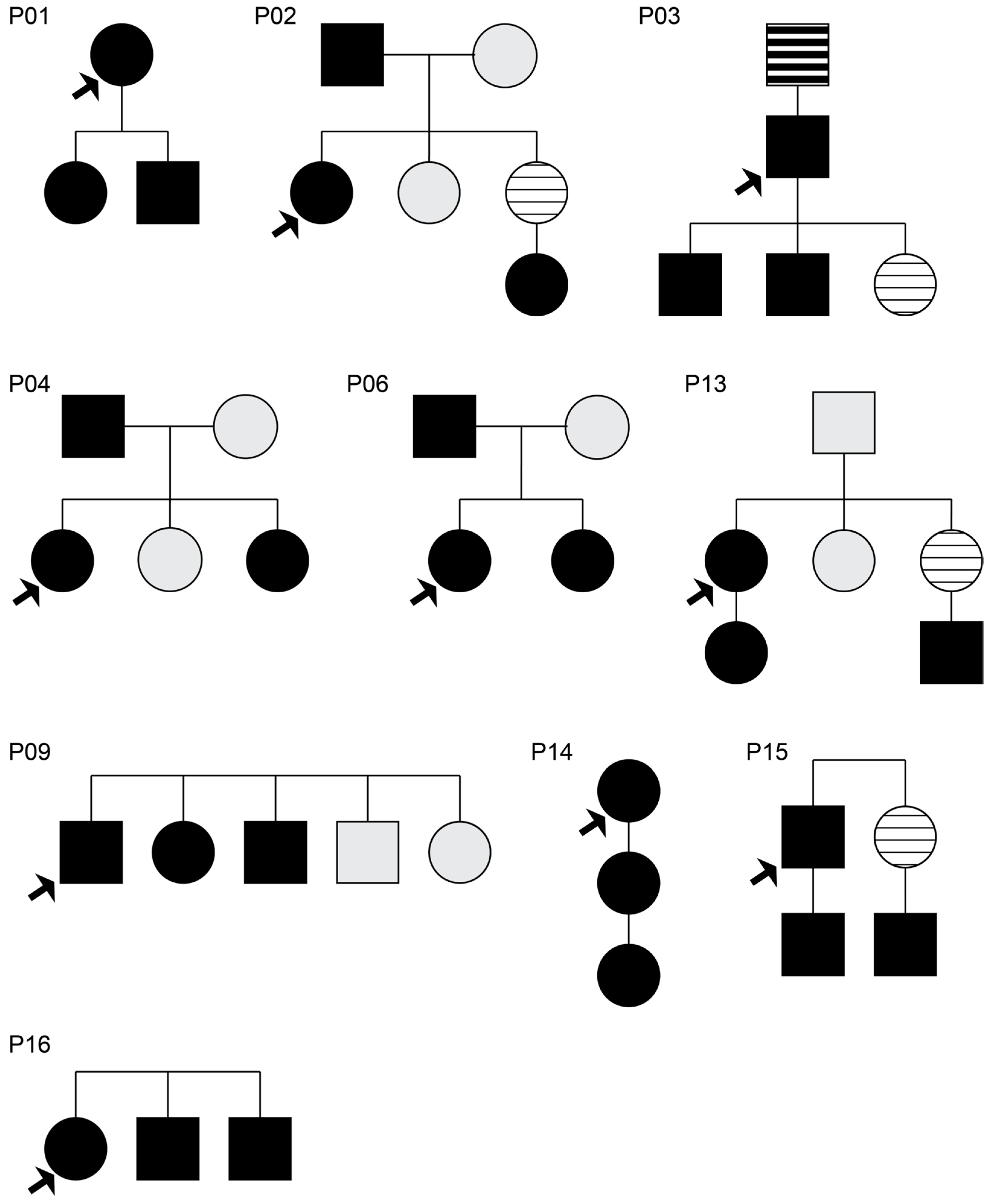 The Complexity of Familial Inheritance in Pectus Excavatum: A Ten ...