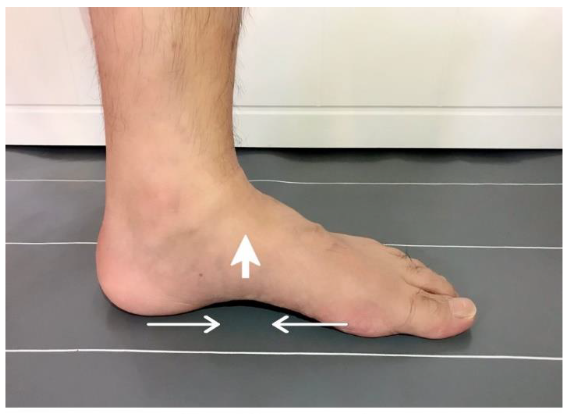 Effect Of Incorporating Short Foot Exercises In The Balance Effect Of Incorporating Short Foot Exercises In The Balance
