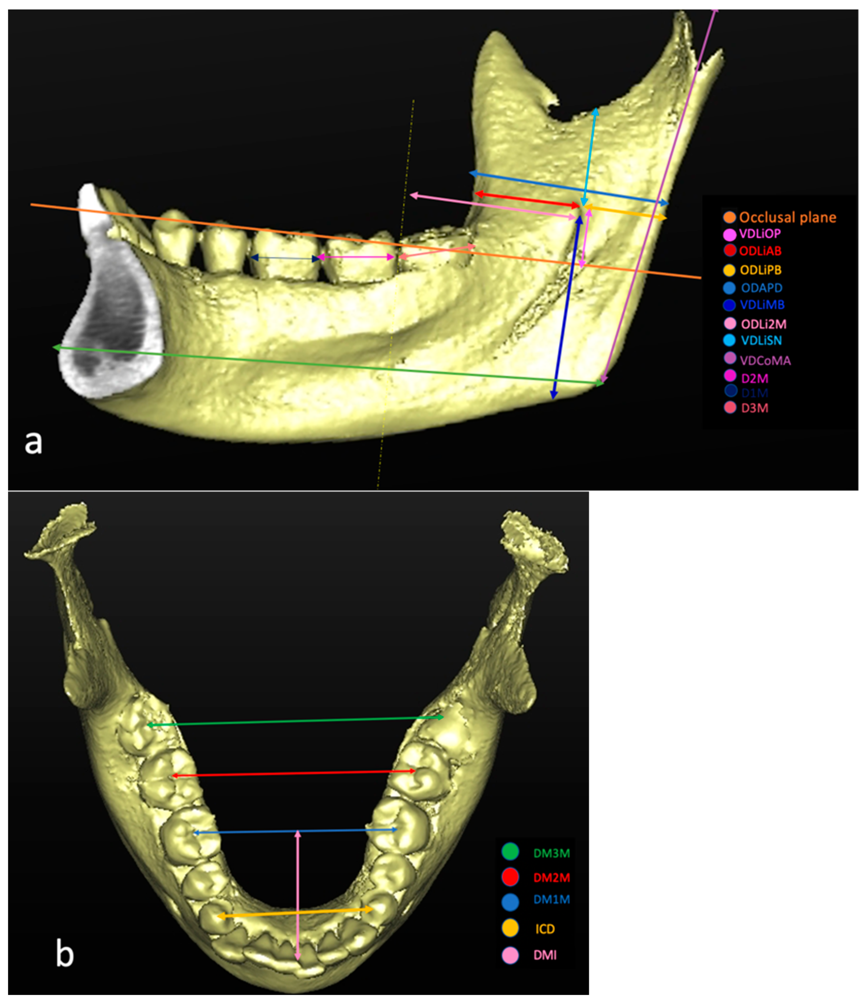 Essential requirements of a non-occlusal mandibu- lar reference position