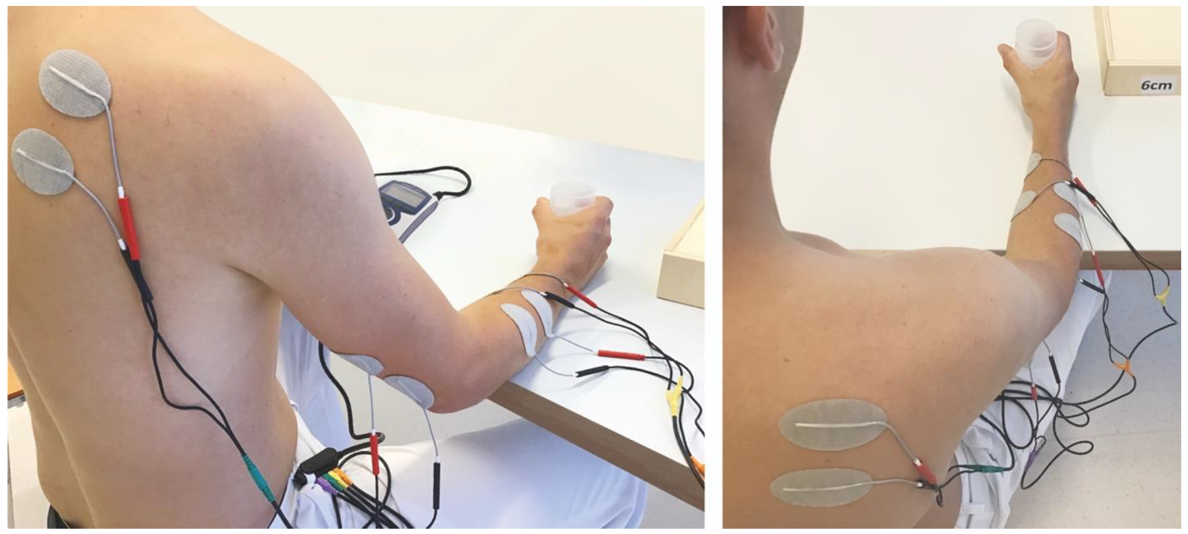 Electrical stimulation found to revitalize muscle perfusion caused by long  COVID
