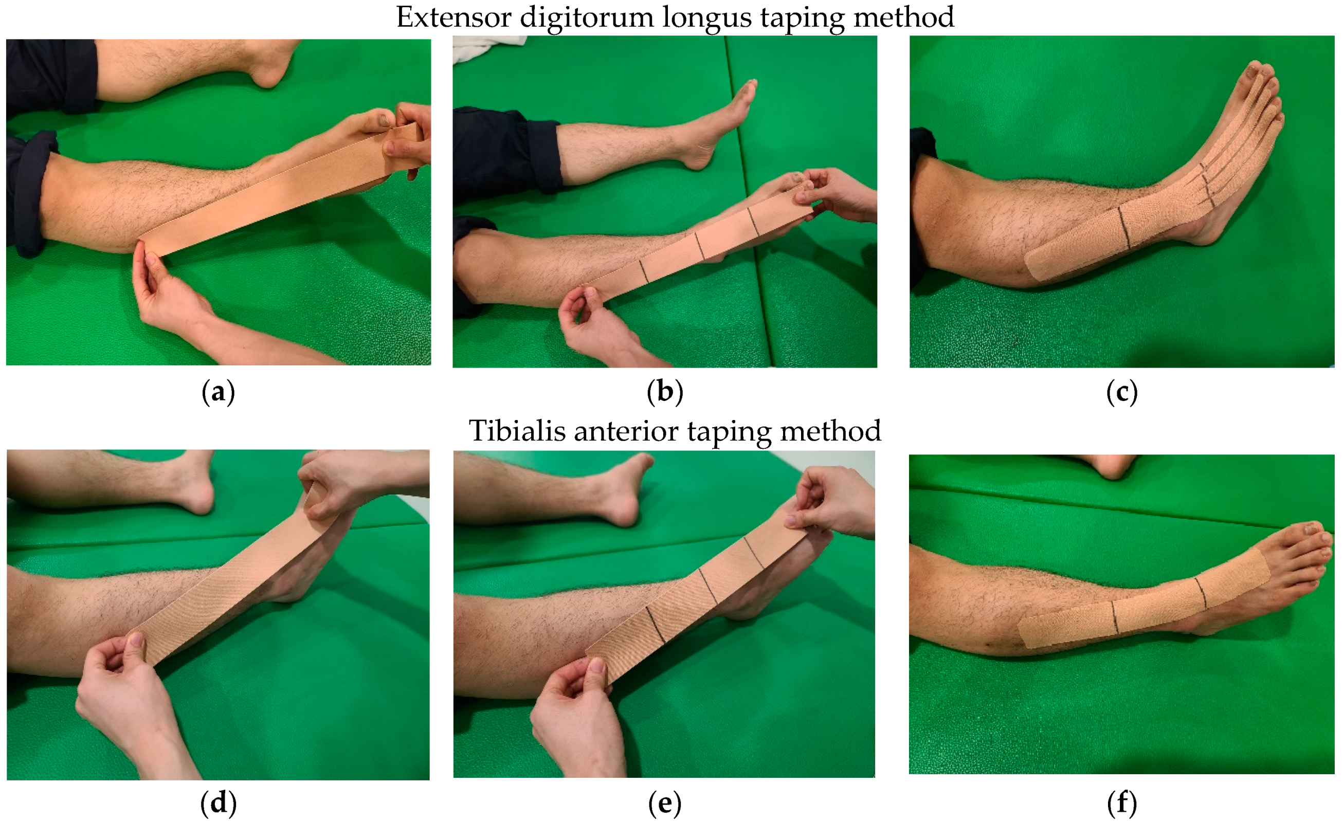 Quantitative assessment of cerebellar ataxia, through automated limb  functional tests | Journal of NeuroEngineering and Rehabilitation | Full  Text