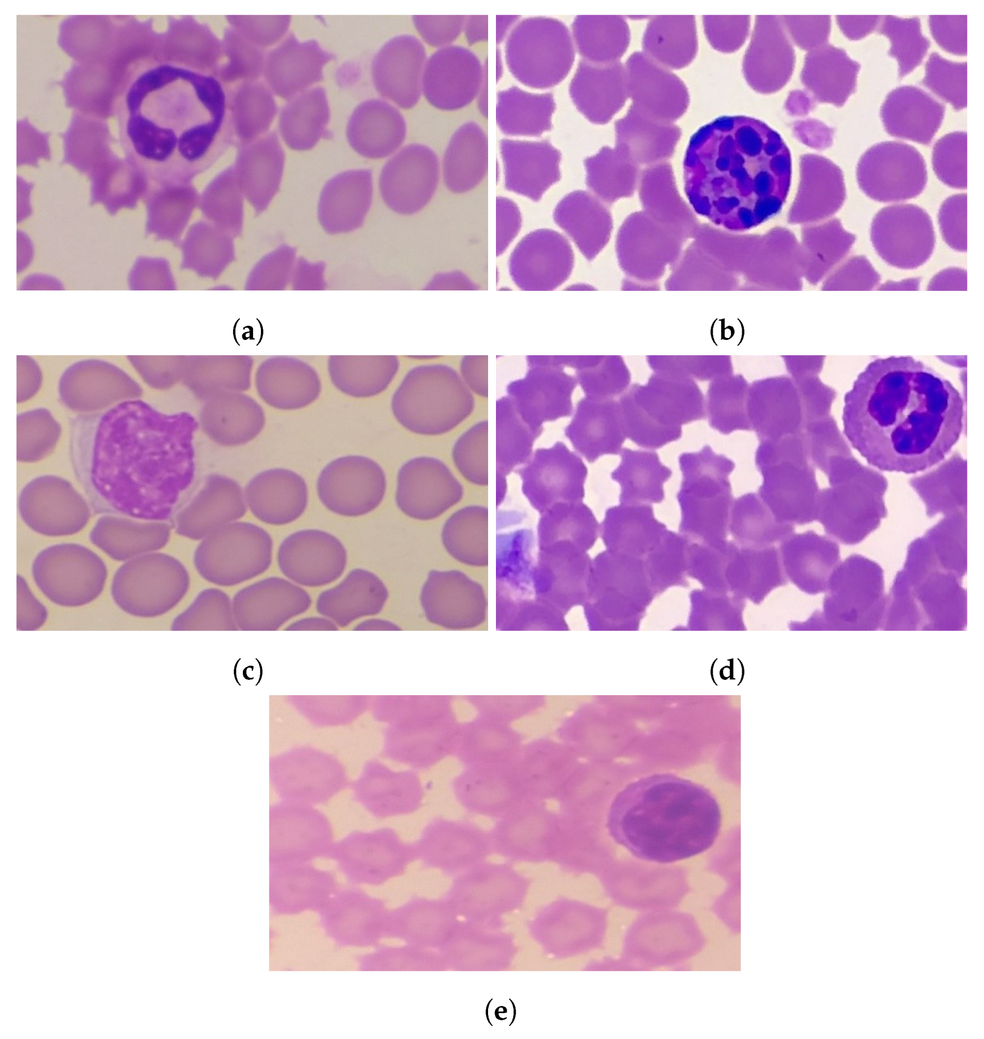 Microscopic View Of White Blood Cells Microscopic View Of White Blood Cells