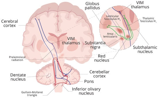 Healthcare | Free Full-Text | On the Effect of Vibrotactile Stimulation ...