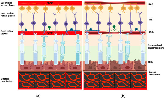 Unlocking the Potential of Vessel Density and the Foveal Avascular Zone ...