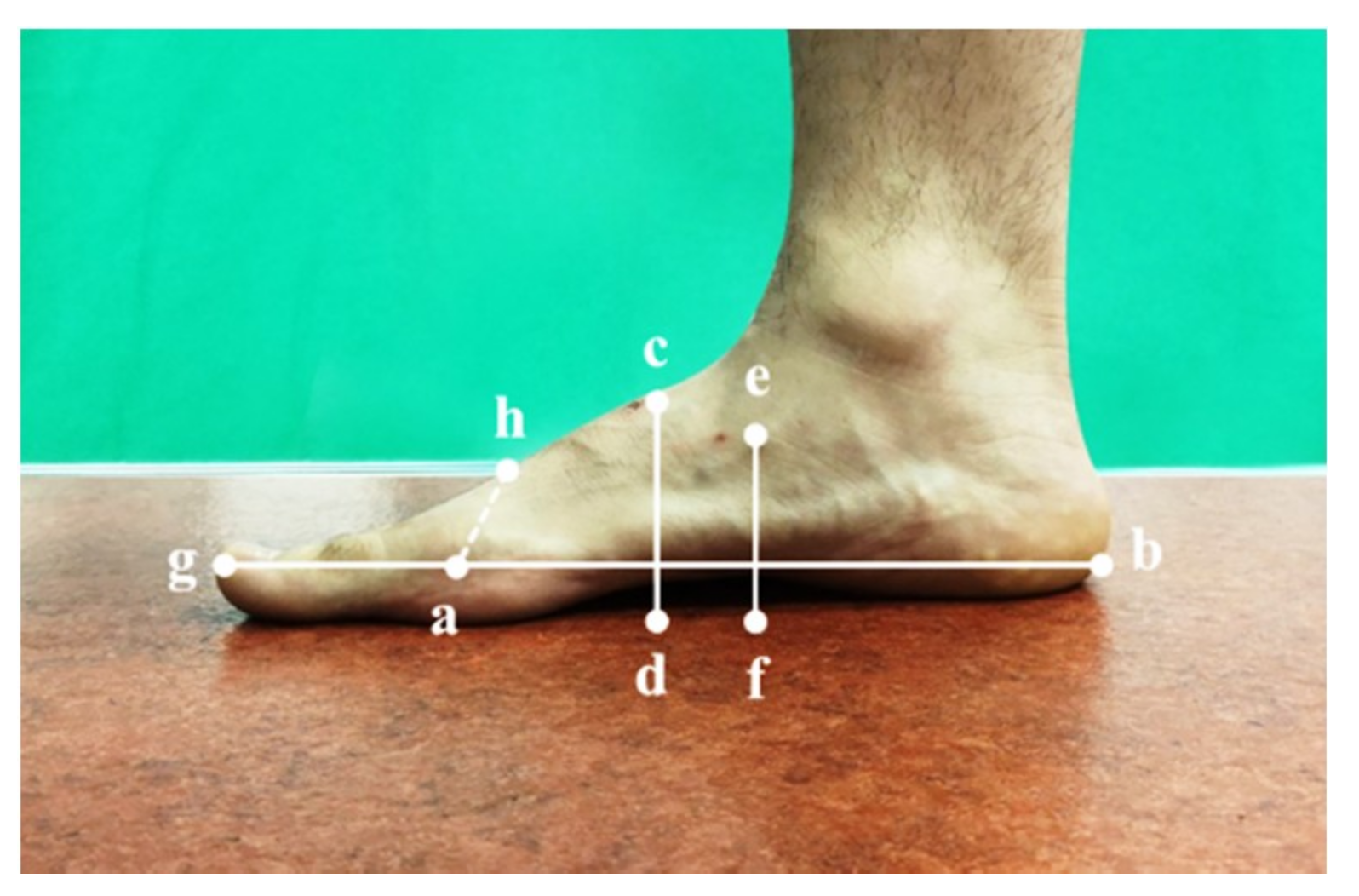 IJERPH | Free Full-Text | Relationships between Foot Morphology and ...