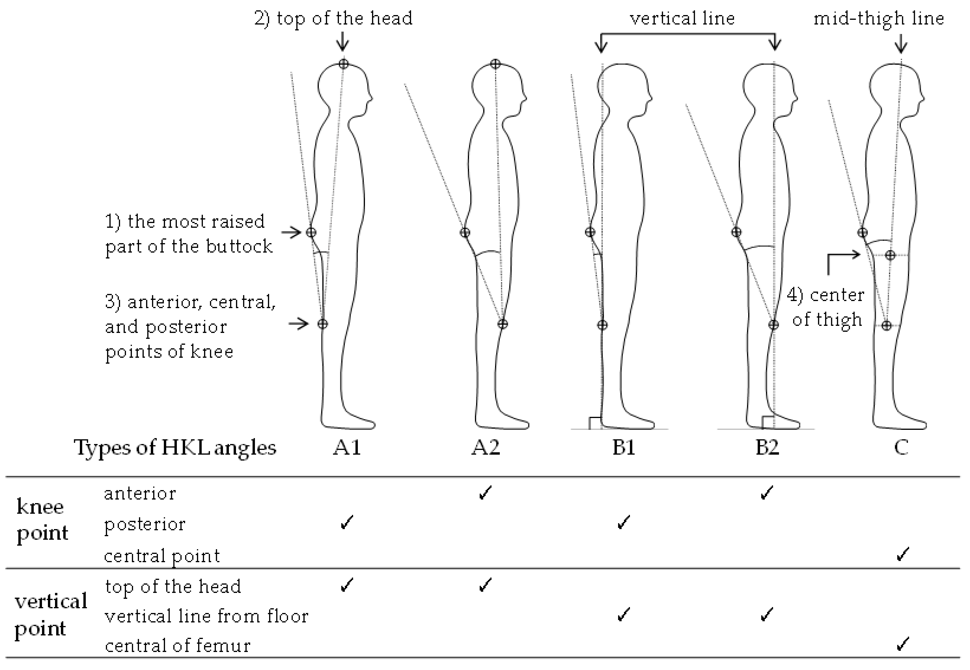 A diagram showing the measurement points on the right iliac crest