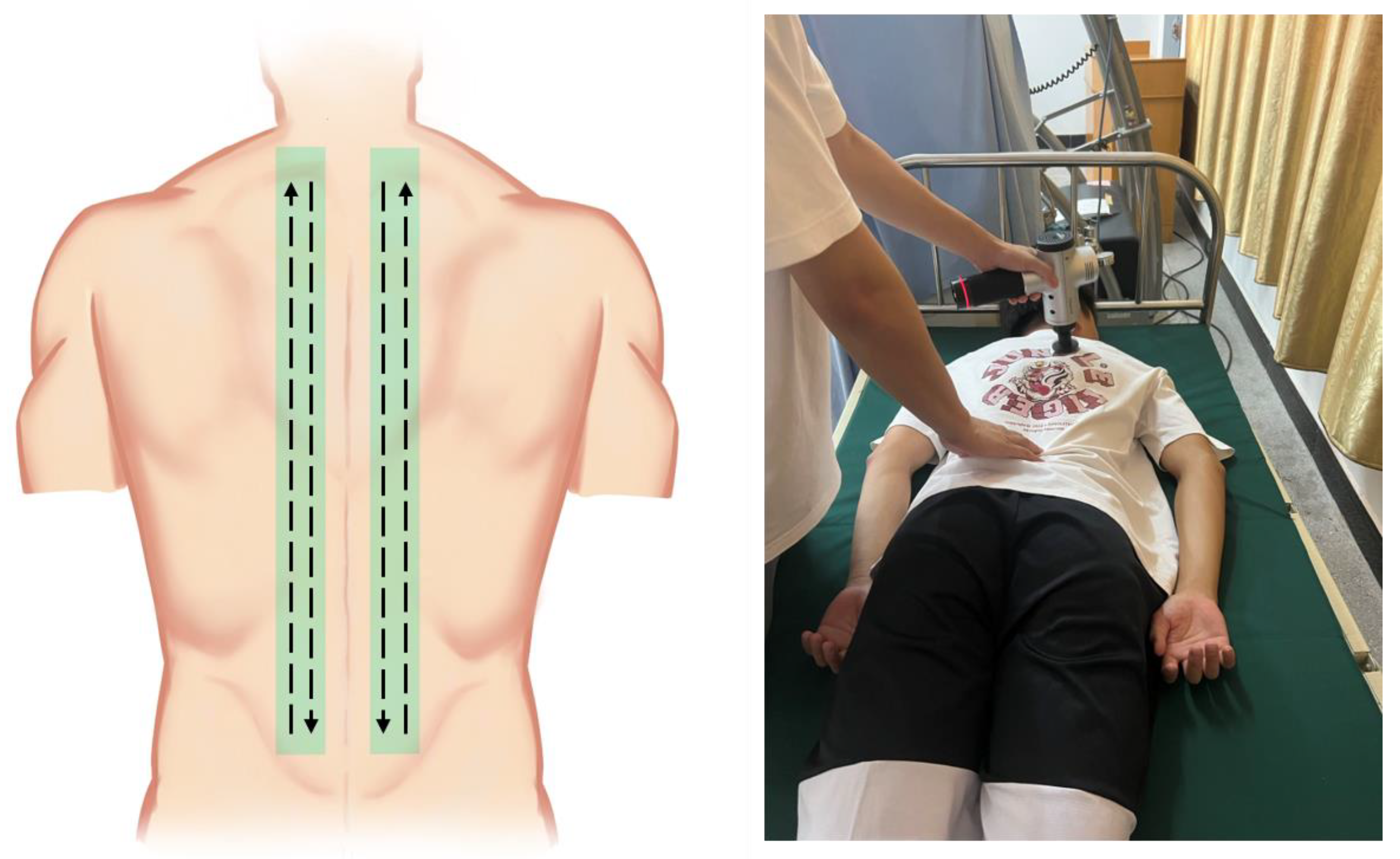 IJERPH Free Full-Text Acute Effects of Percussive Massage Therapy on Thoracolumbar Fascia Thickness and Ultrasound Echo Intensity in Healthy Male Individuals A Randomized Controlled Trial image