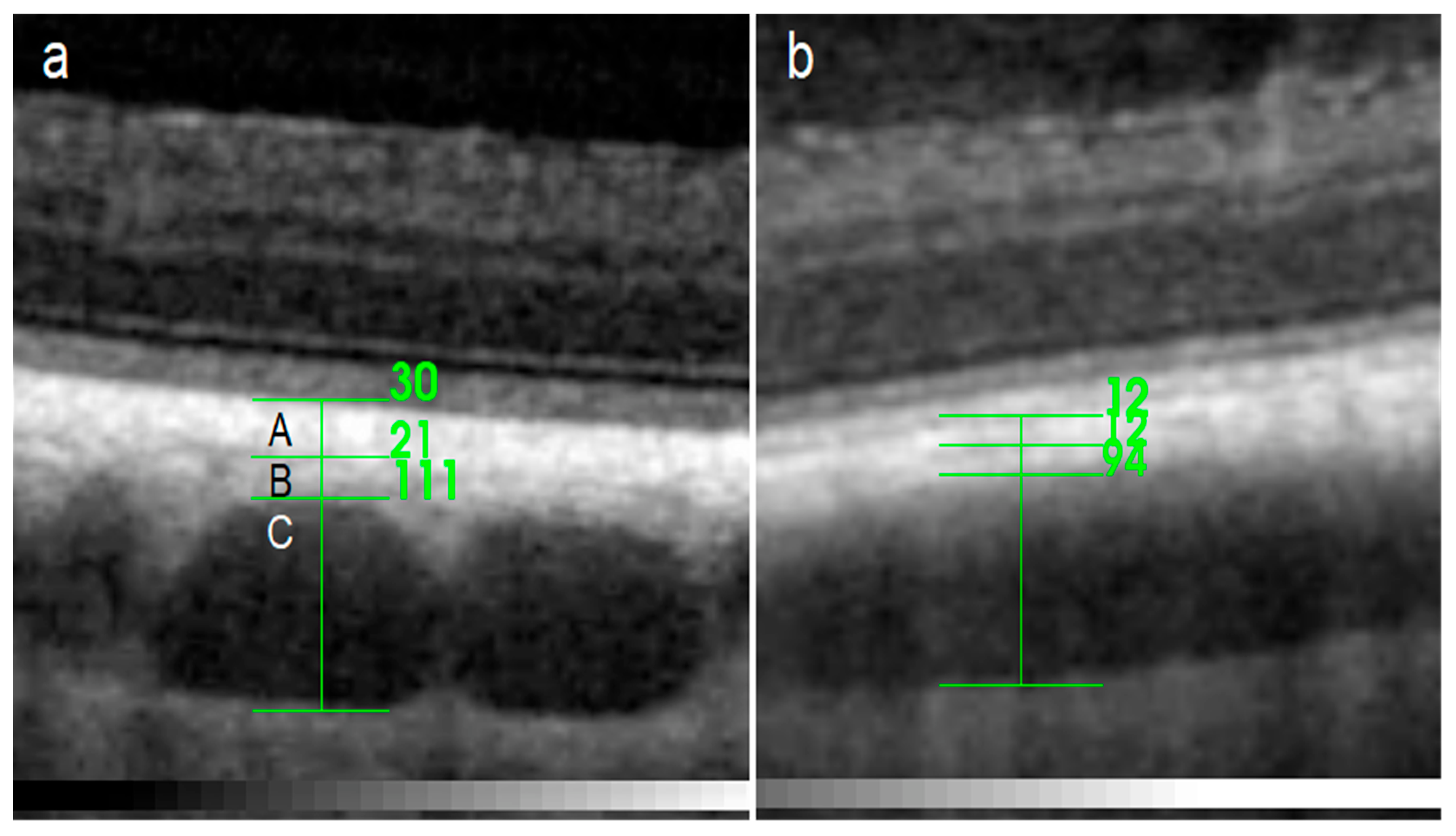 Tapetum Lucidum Histology Tapetum Lucidum Histology