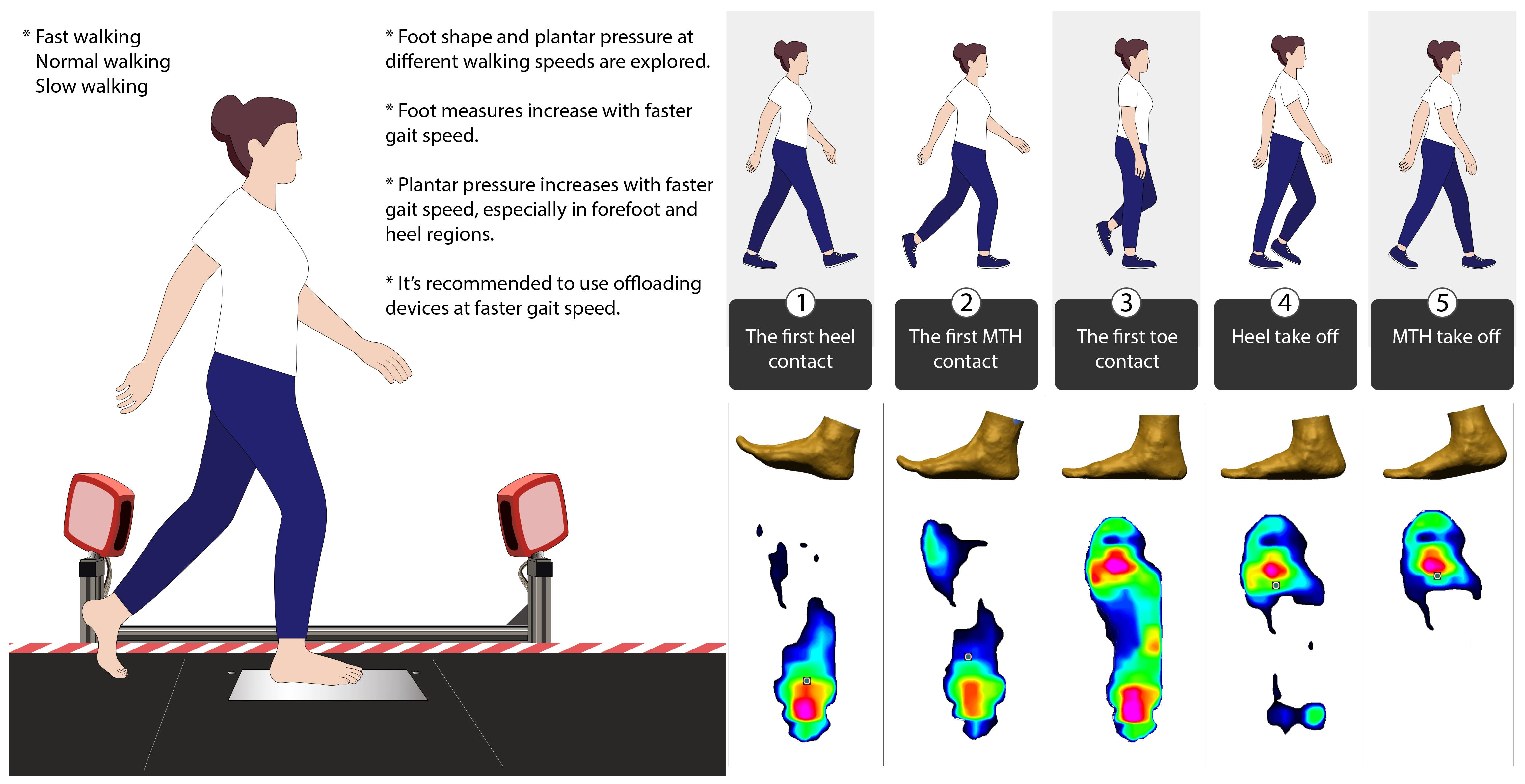 The efficacy of removable devices to offload and heal neuropathic plantar  forefoot ulcers in people with diabetes: a single‐blinded multicentre  randomised controlled trial - Bus - 2018 - International Wound Journal -  Wiley Online Library