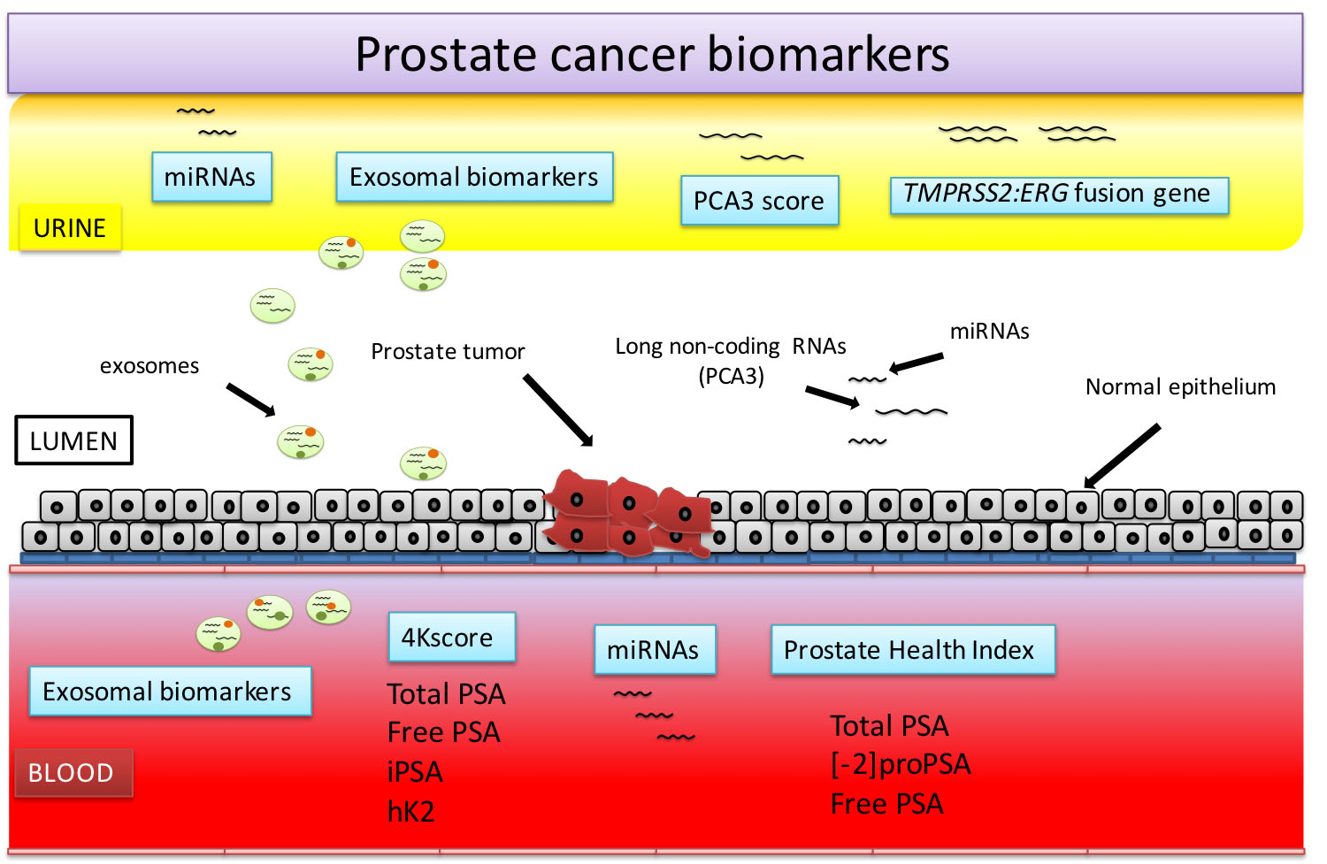 IJMS | Free Full-Text | Prostate Cancer Detection and Prognosis 