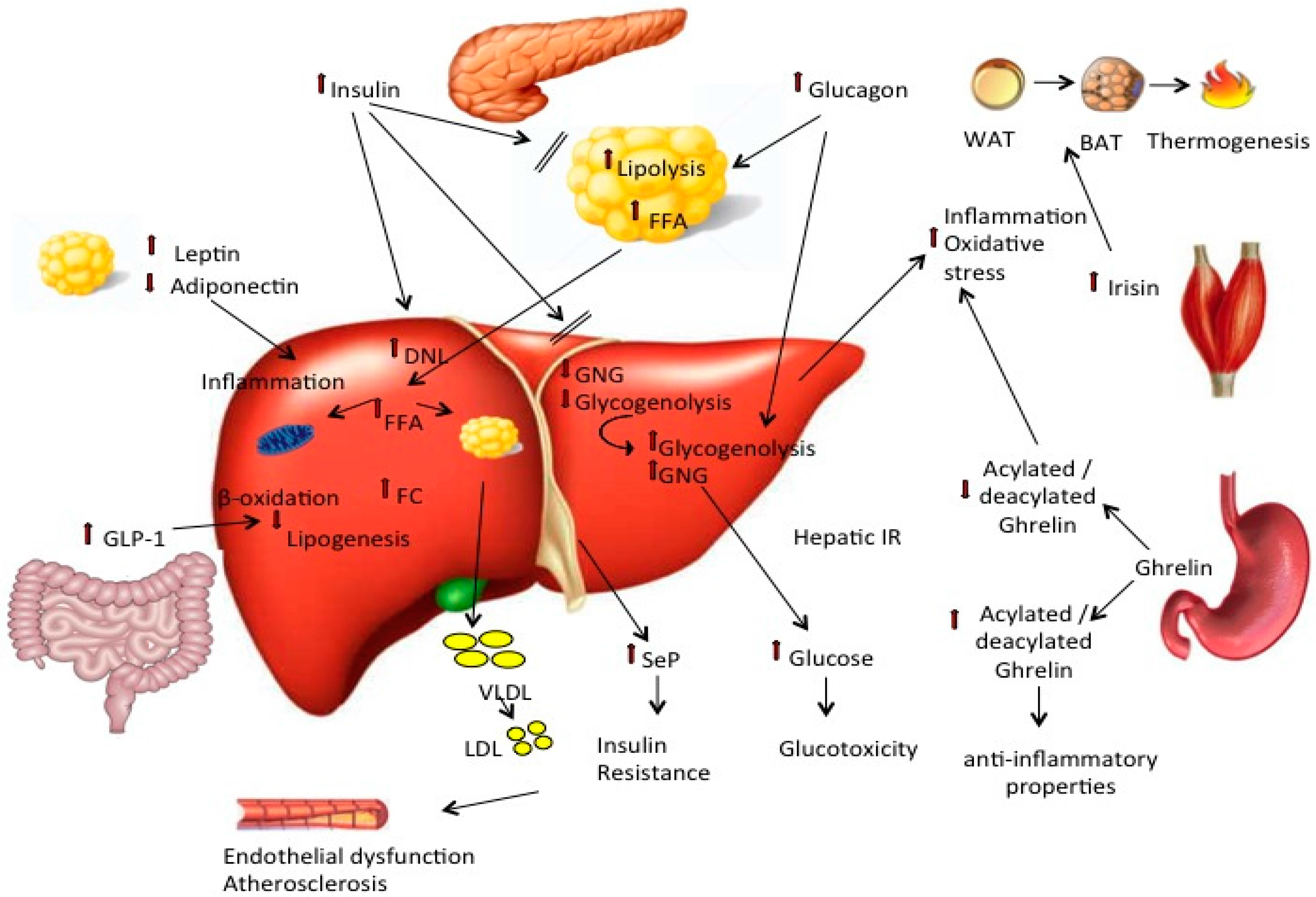 Ijms Free Full Text Pathophysiology Of Non Alcoholic Fatty Liver Disease