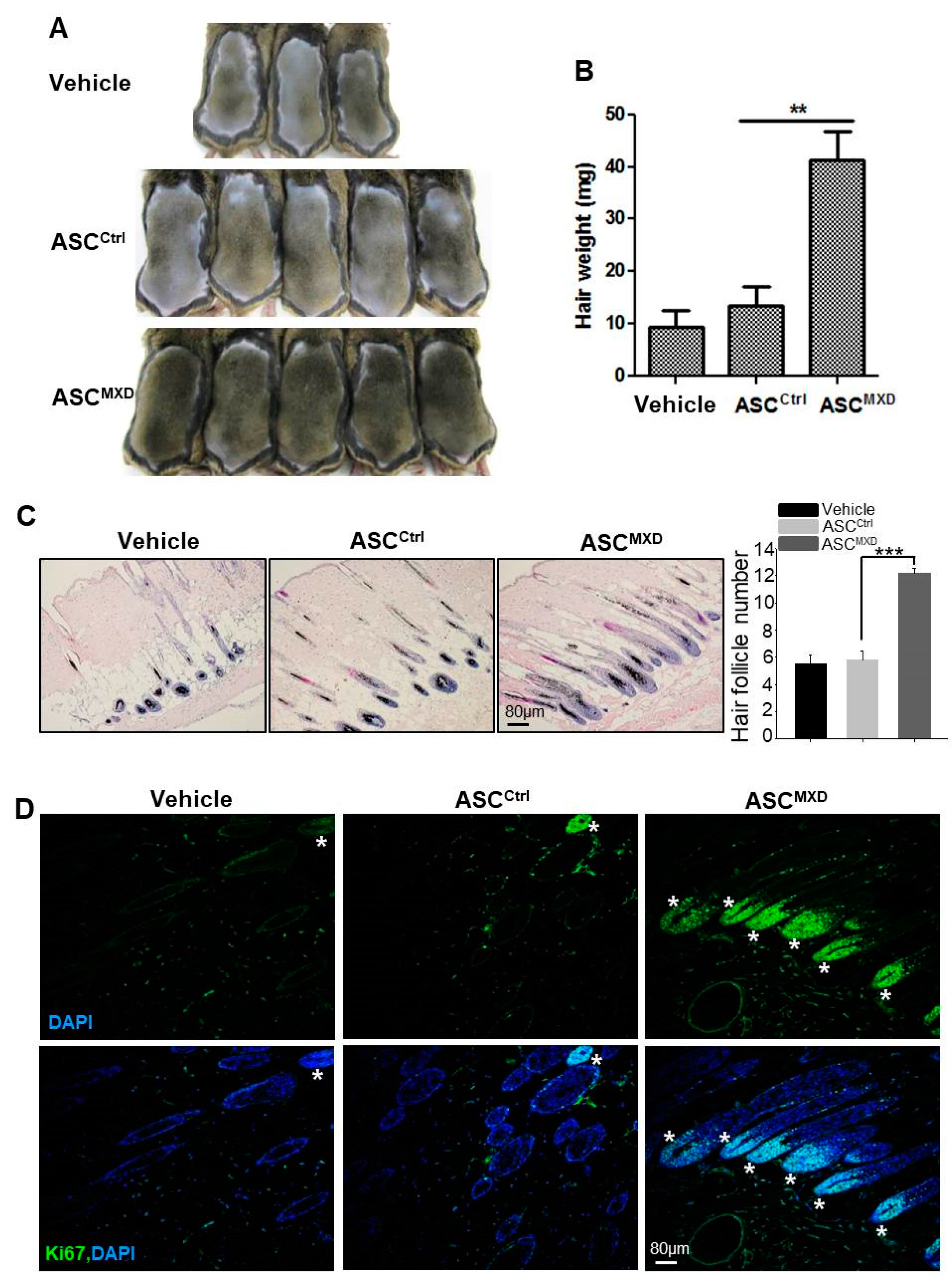IJMS | Full-Text | Minoxidil Promotes Hair Growth through Stimulation Growth Factor Release from Adipose-Derived Stem Cells
