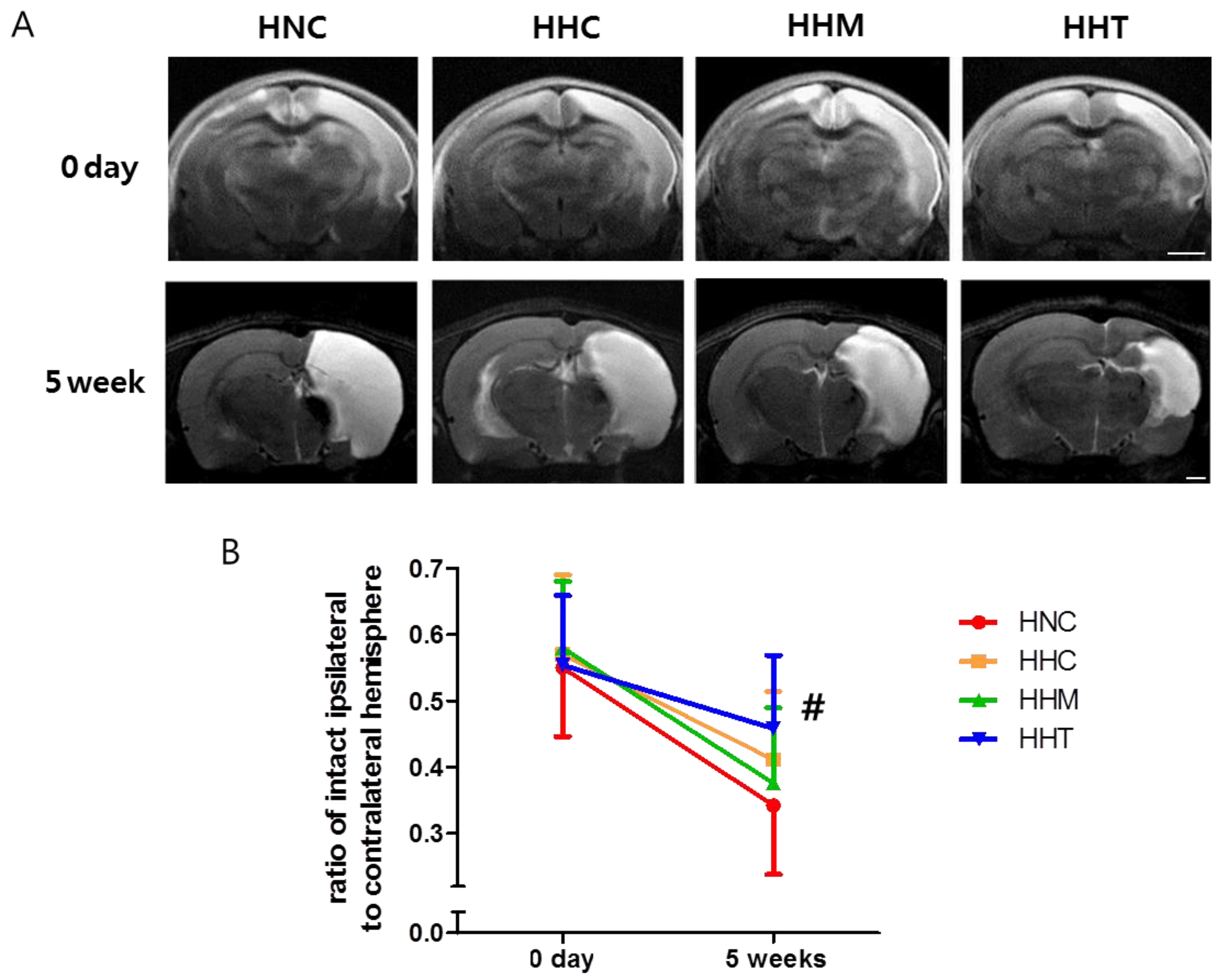 IJMS | Free Full-Text | Thrombin Preconditioning Enhances Therapeutic ...