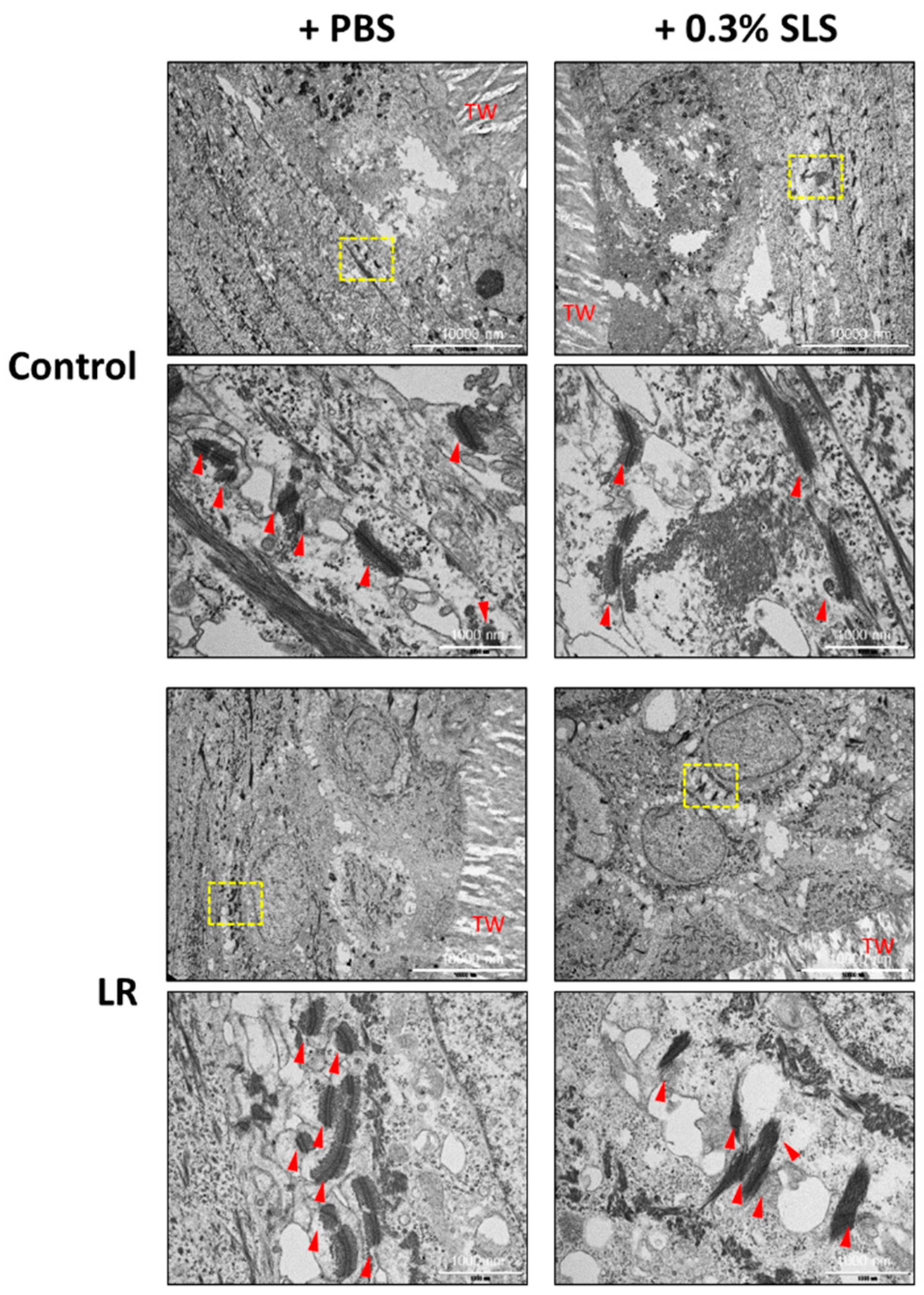 Light microscopy of Lactobacillus rhamnosus E/N (a, b) and PEN (c, d).