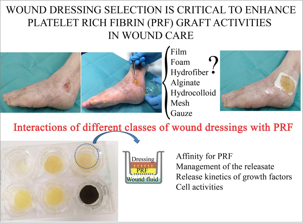 Science of Wound Healing and Dressing Materials | SpringerLink