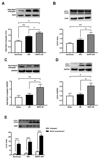 IJMS | Free Full-Text | Remote Ischemic Preconditioning Induces