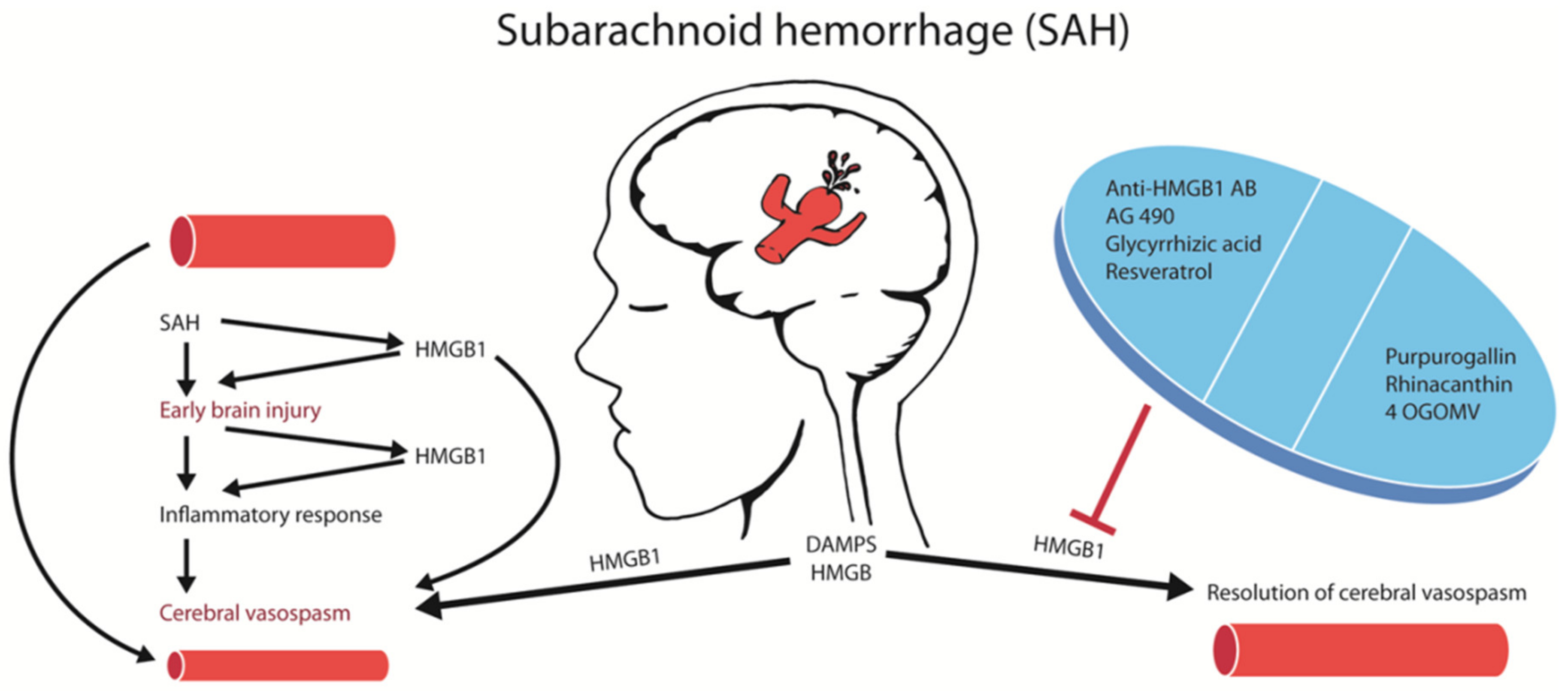 What is a Subarachnoid Hemorrhage (SAH)?