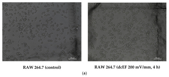 Hub Proteins Involved in RAW 264.7 Macrophages Exposed to Direct ...