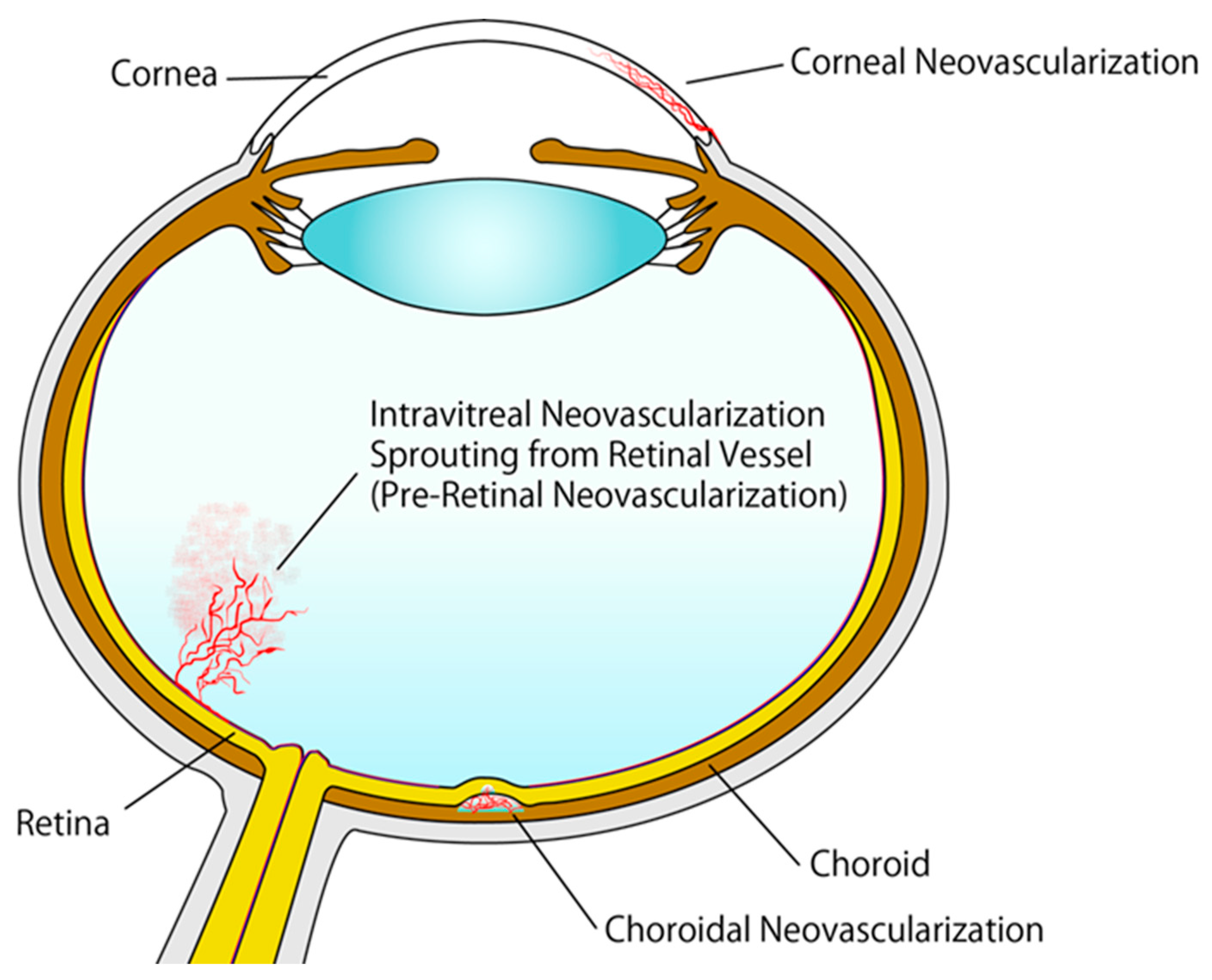 Lipid Signaling In Ocular Neovascularization Lipid Signaling In Ocular Neovascularization
