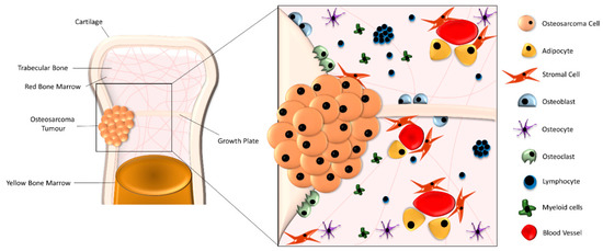 The Role of Pre-Clinical 3-Dimensional Models of Osteosarcoma