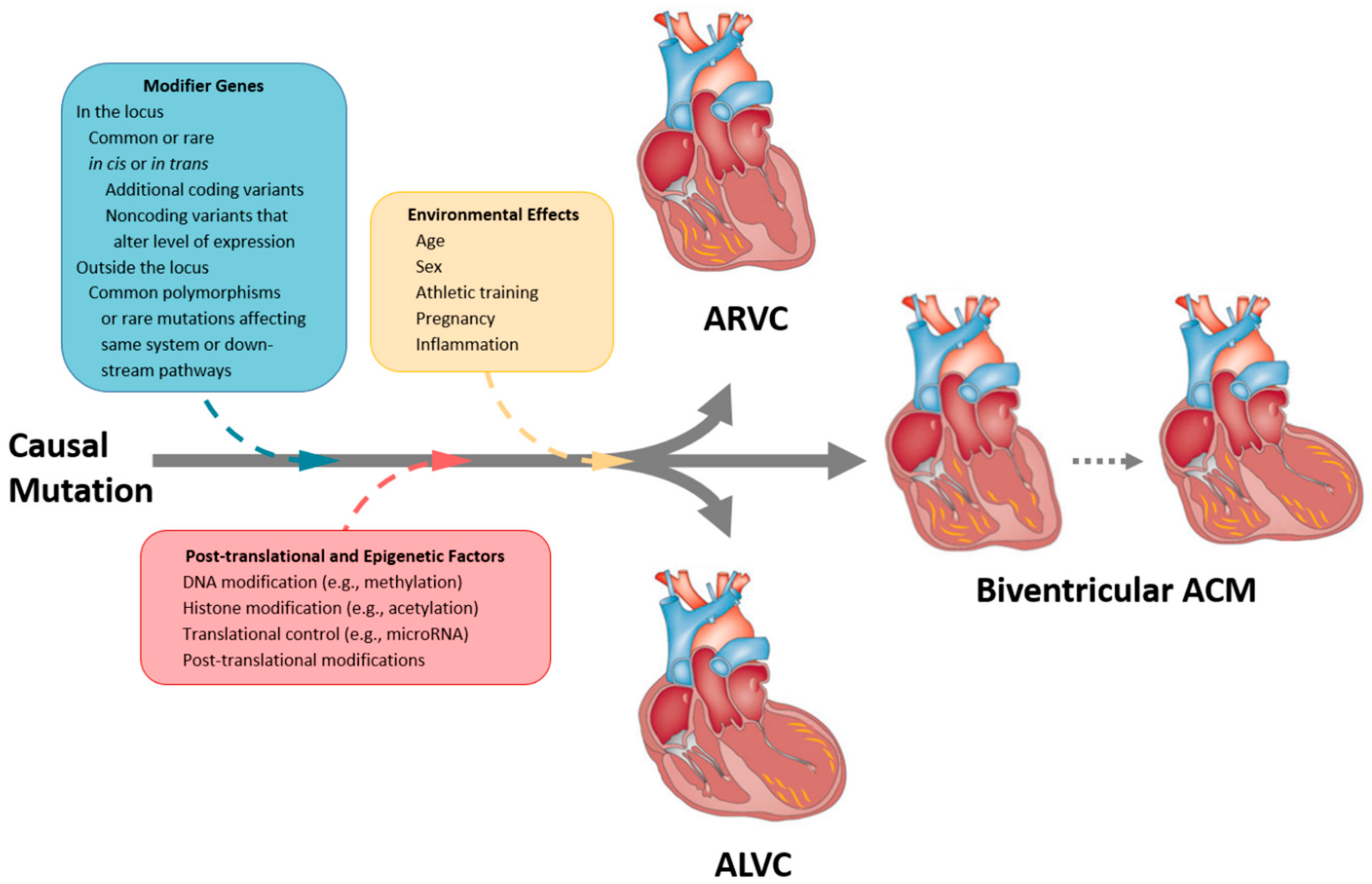 Left Ventricular Dysfunction in Arrhythmogenic Cardiomyopathy: Association  With Exercise Exposure, Genetic Basis, and Prognosis