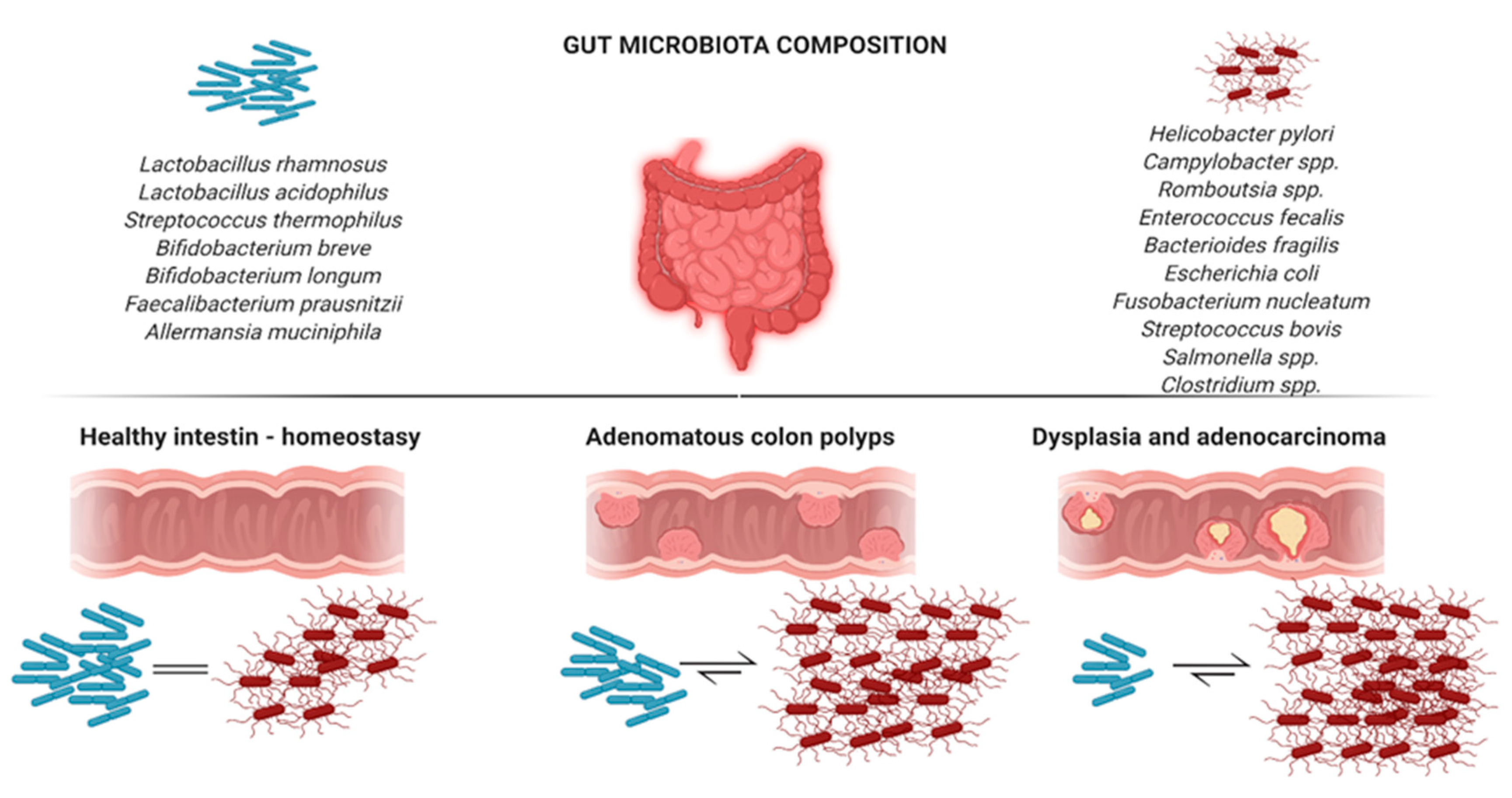 IJMS | Free Full-Text | An Overview of Gut Microbiota and Colon ...