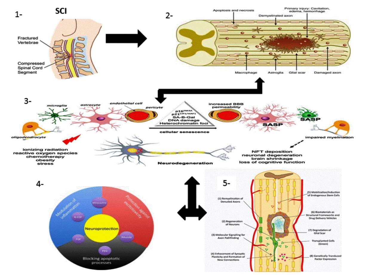 Pathophysiology Of Spinal Cord Injury Sci A The Diagr - vrogue.co