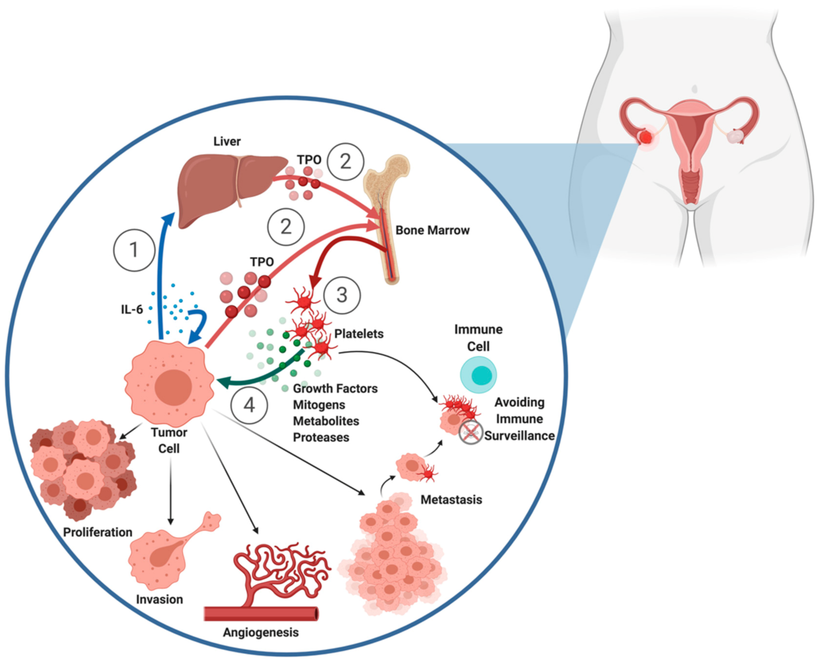Platelets, Thrombocytosis, and Ovarian Cancer Prognosis Platelets, Thrombocytosis, and Ovarian Cancer Prognosis