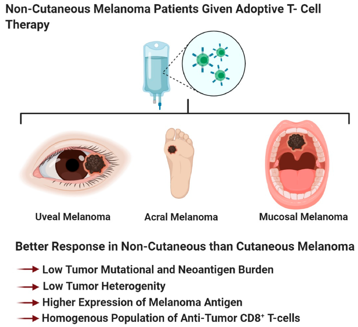 How melanoma evades the immune system