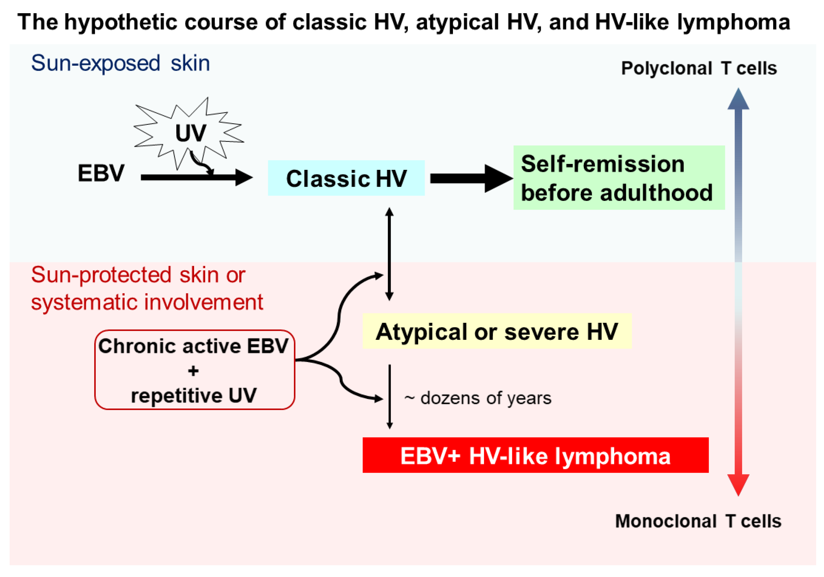 Hydroa Vacciniforme And Hydroa Vacciniforme Like Lymphoproliferative Hydroa Vacciniforme And Hydroa Vacciniforme Like Lymphoproliferative