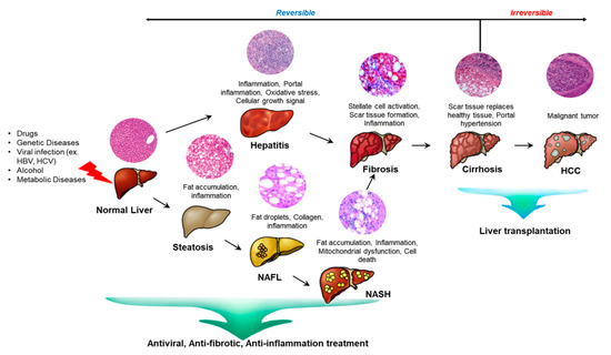 Research Trends in the Efficacy of Stem Cell Therapy for Hepatic ...