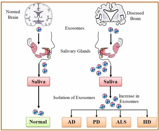 IJMS | Free Full-Text | The Evolving Landscape of Exosomes in  Neurodegenerative Diseases: Exosomes Characteristics and a Promising Role  in Early Diagnosis