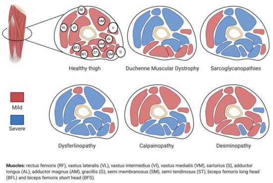 Muscle Diseases (神経学) Muscle Diseases (神経学) 本