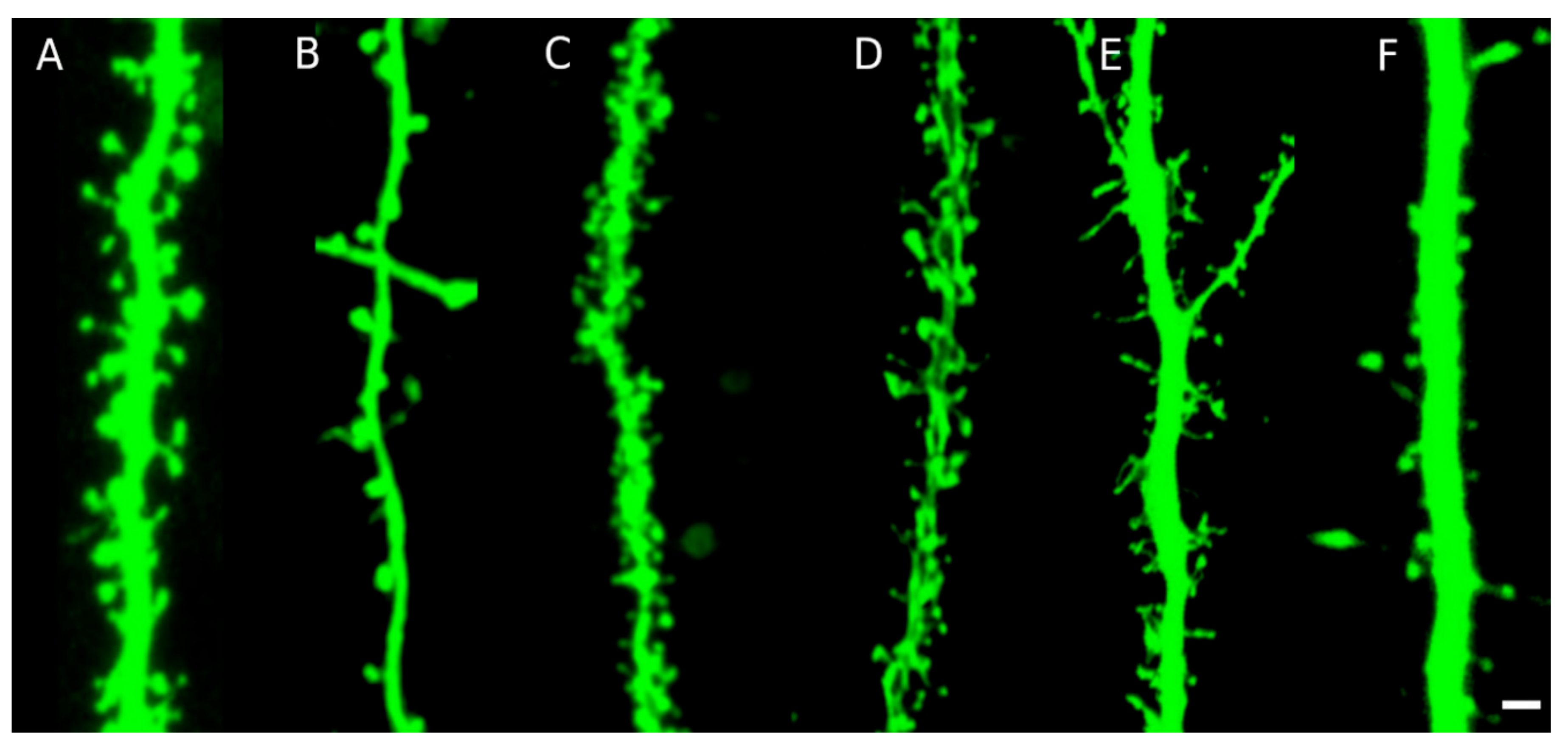 dendritic spine synapse