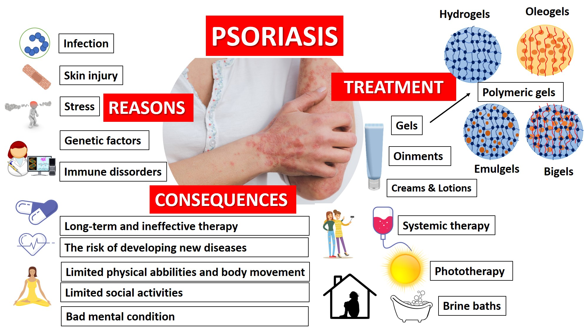 latest research psoriasis treatment